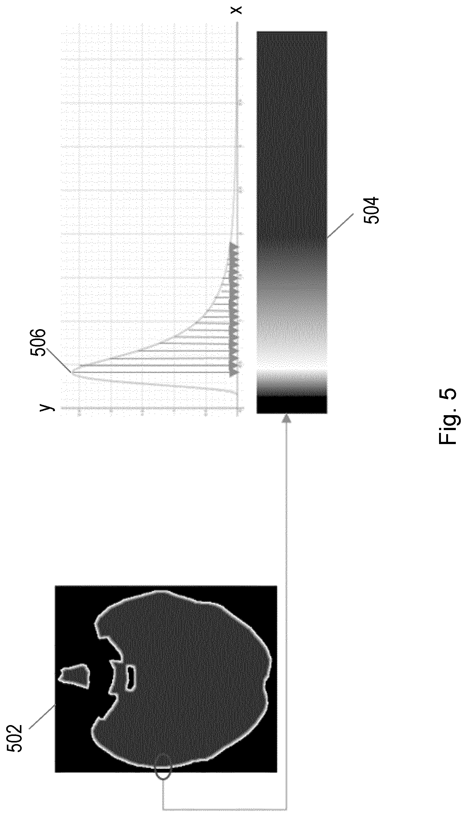 Patent US12315159 Figure 5 – Image processing for stroke characterization