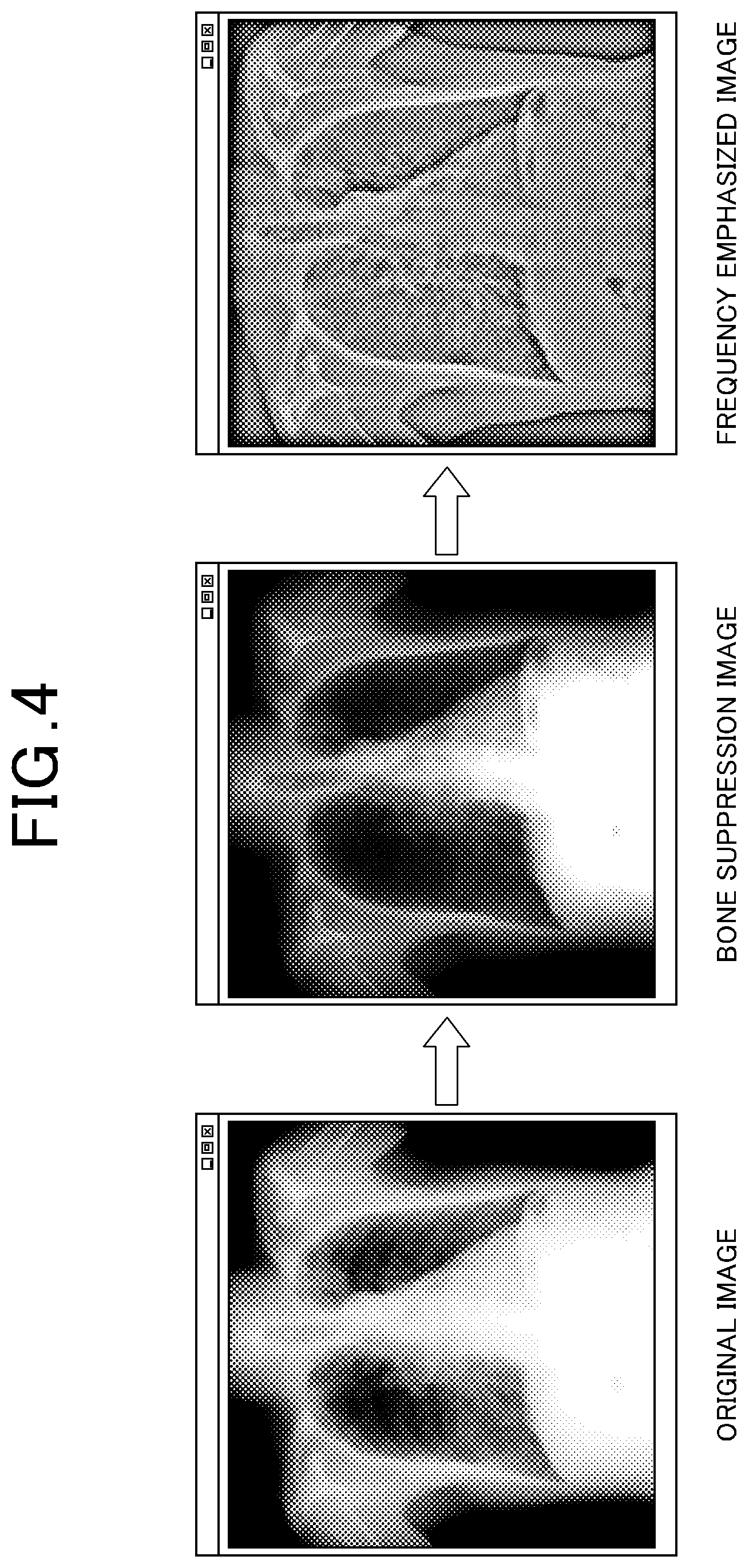 Patent US12315163 Figure 4 – Dynamic image analysis apparatus and storage medium