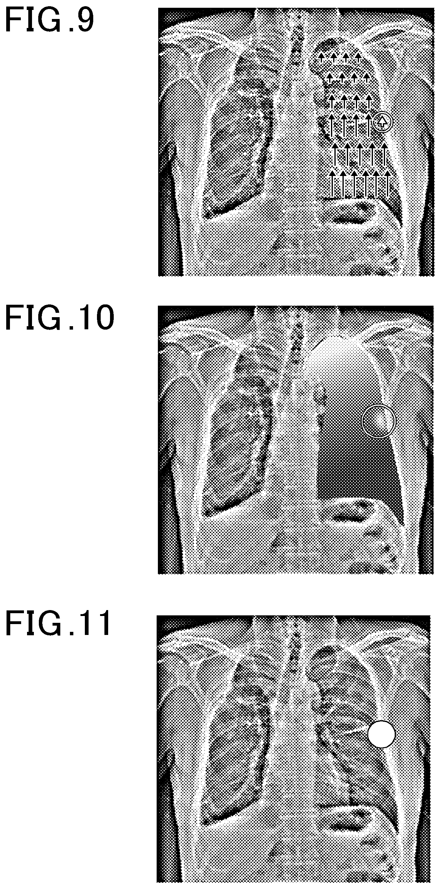 Patent US12315163 Figure 9 – Dynamic image analysis apparatus and storage medium