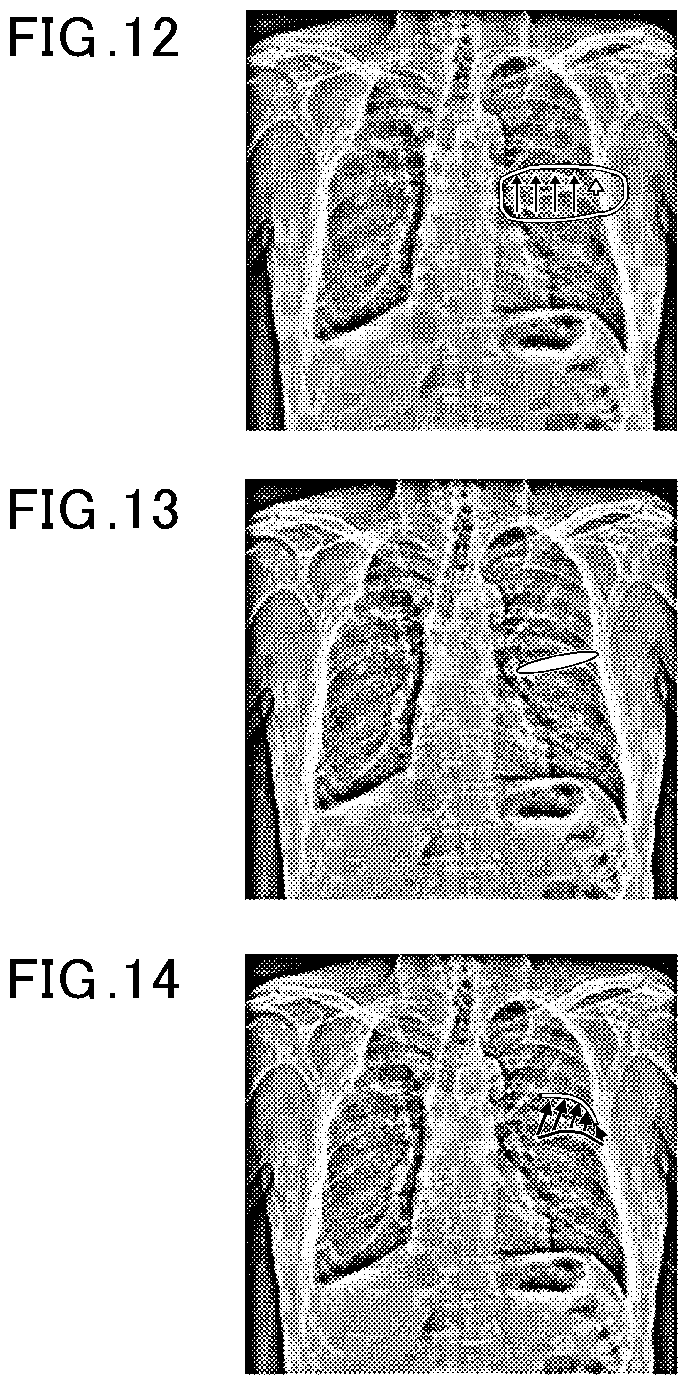 Patent US12315163 Figure 10 – Dynamic image analysis apparatus and storage medium