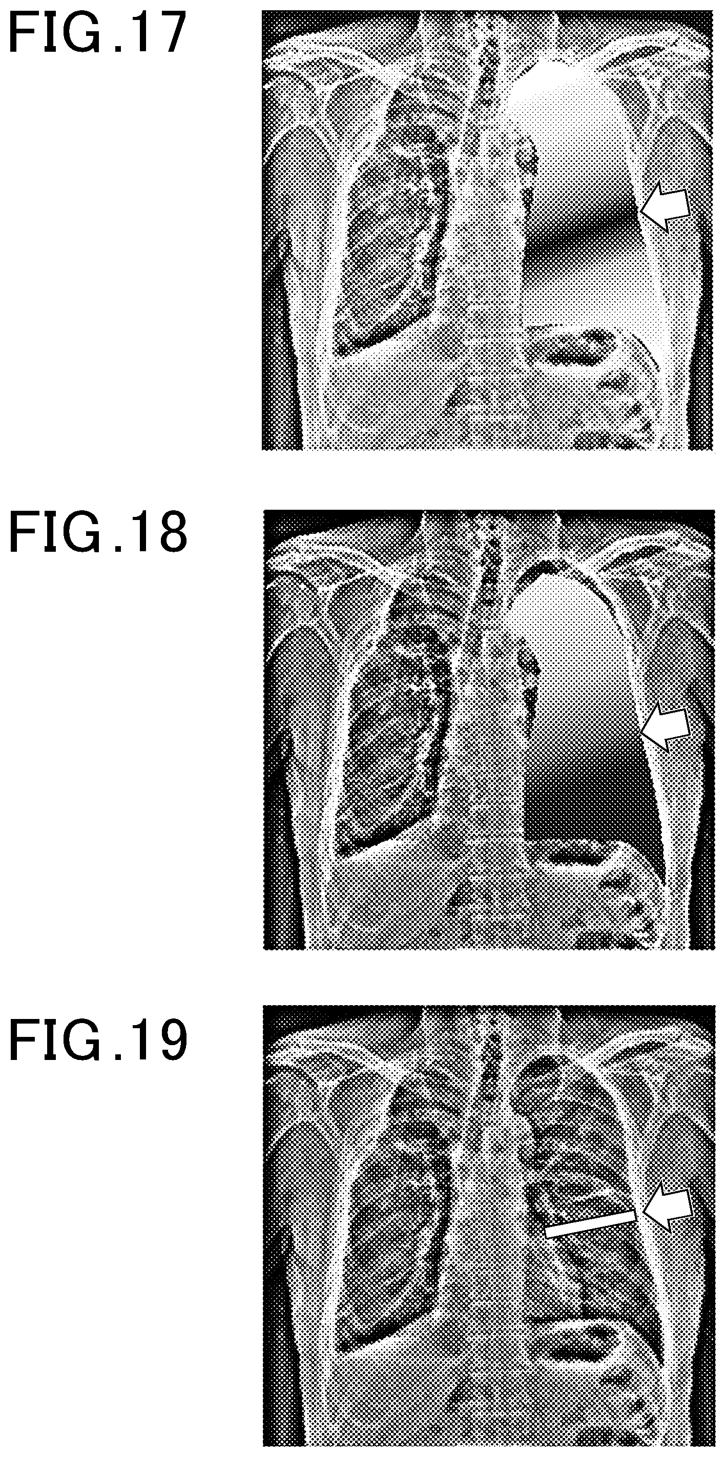 Patent US12315163 Figure 13 – Dynamic image analysis apparatus and storage medium