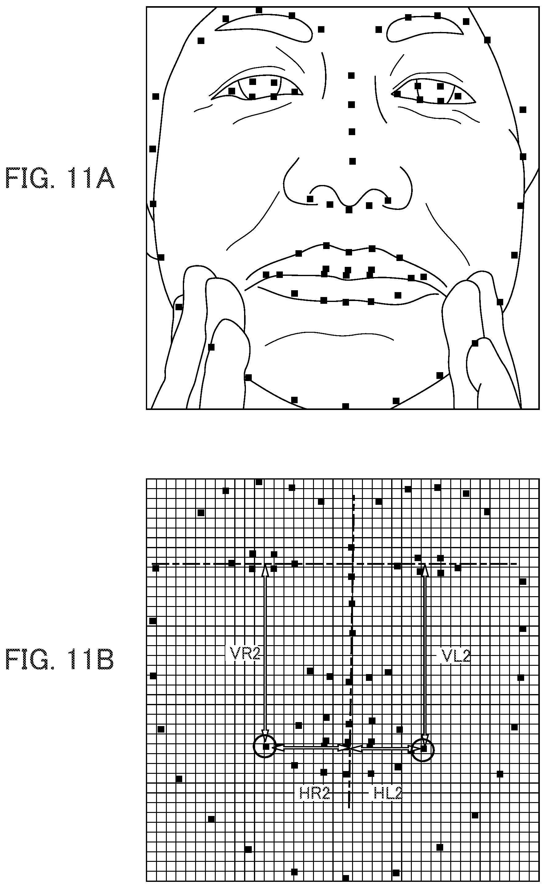 Patent US12315164 Figure 11 – Image processing device, image processing method, and storage medium