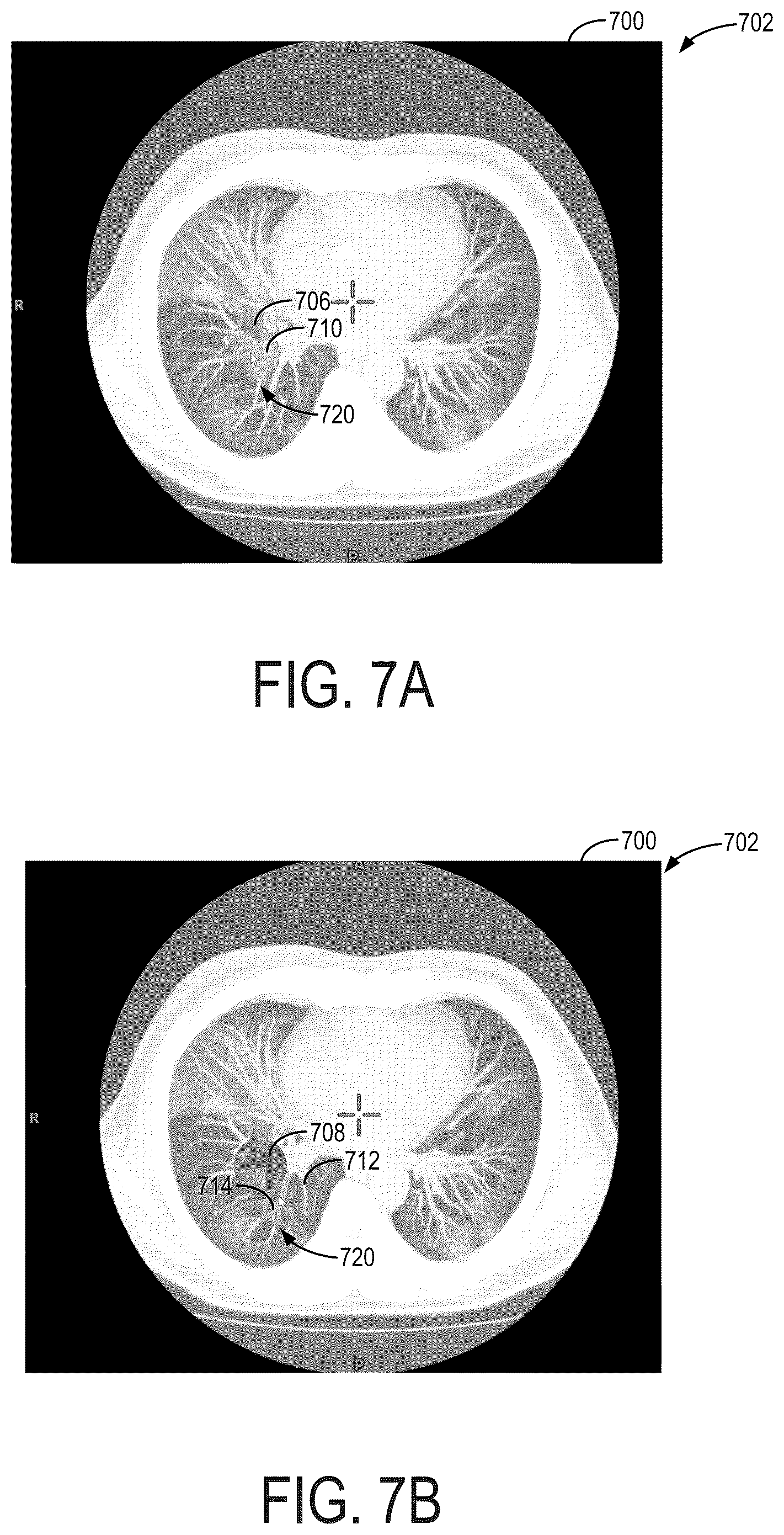 Patent US12315167 Figure 6 – 3D interactive annotation using projected views