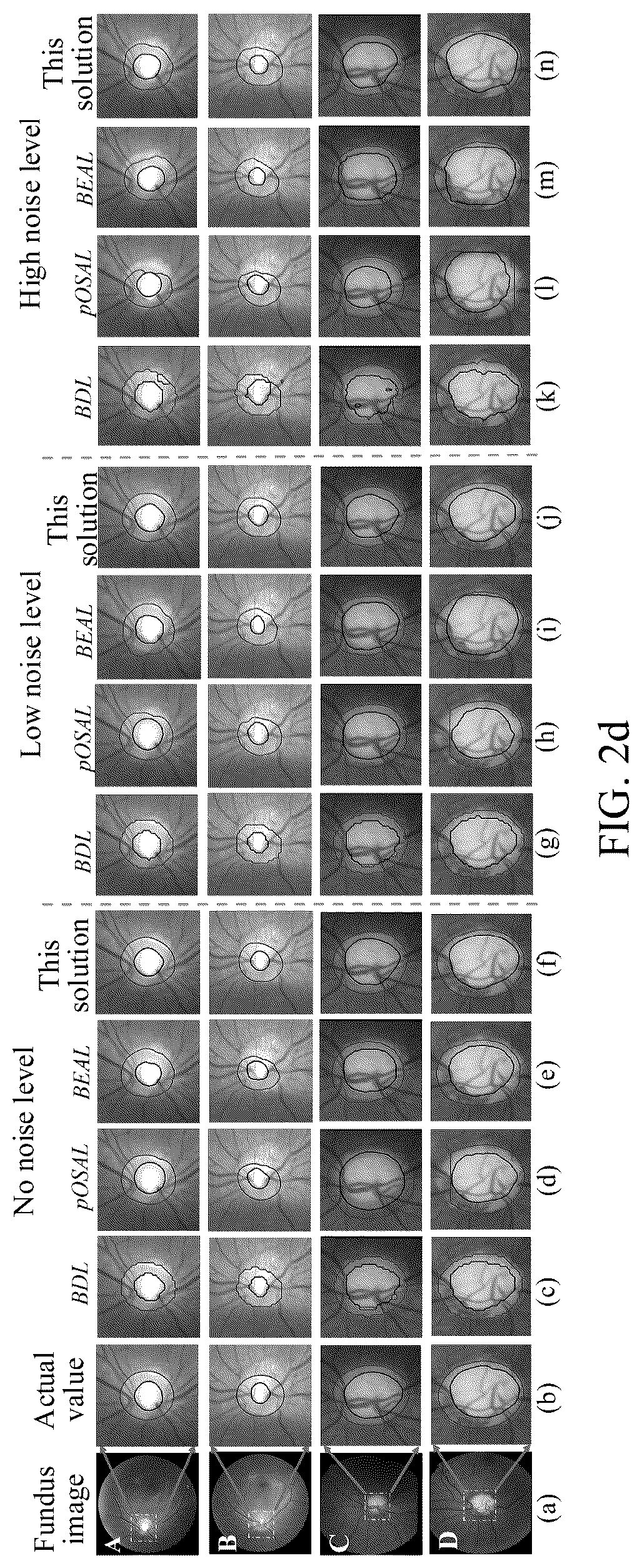 Patent US12315168 Figure 5 – Image segmentation method and apparatus and storage medium