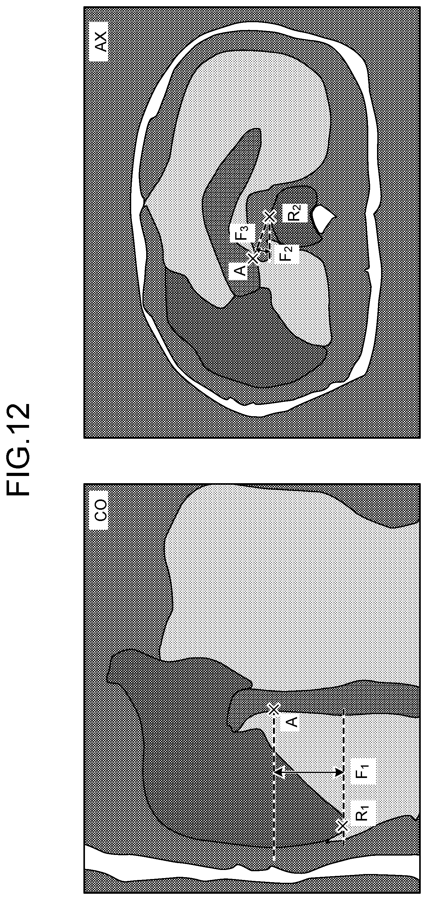 Patent US12315213 Figure 11 – Medical image processing apparatus and medical image processing method