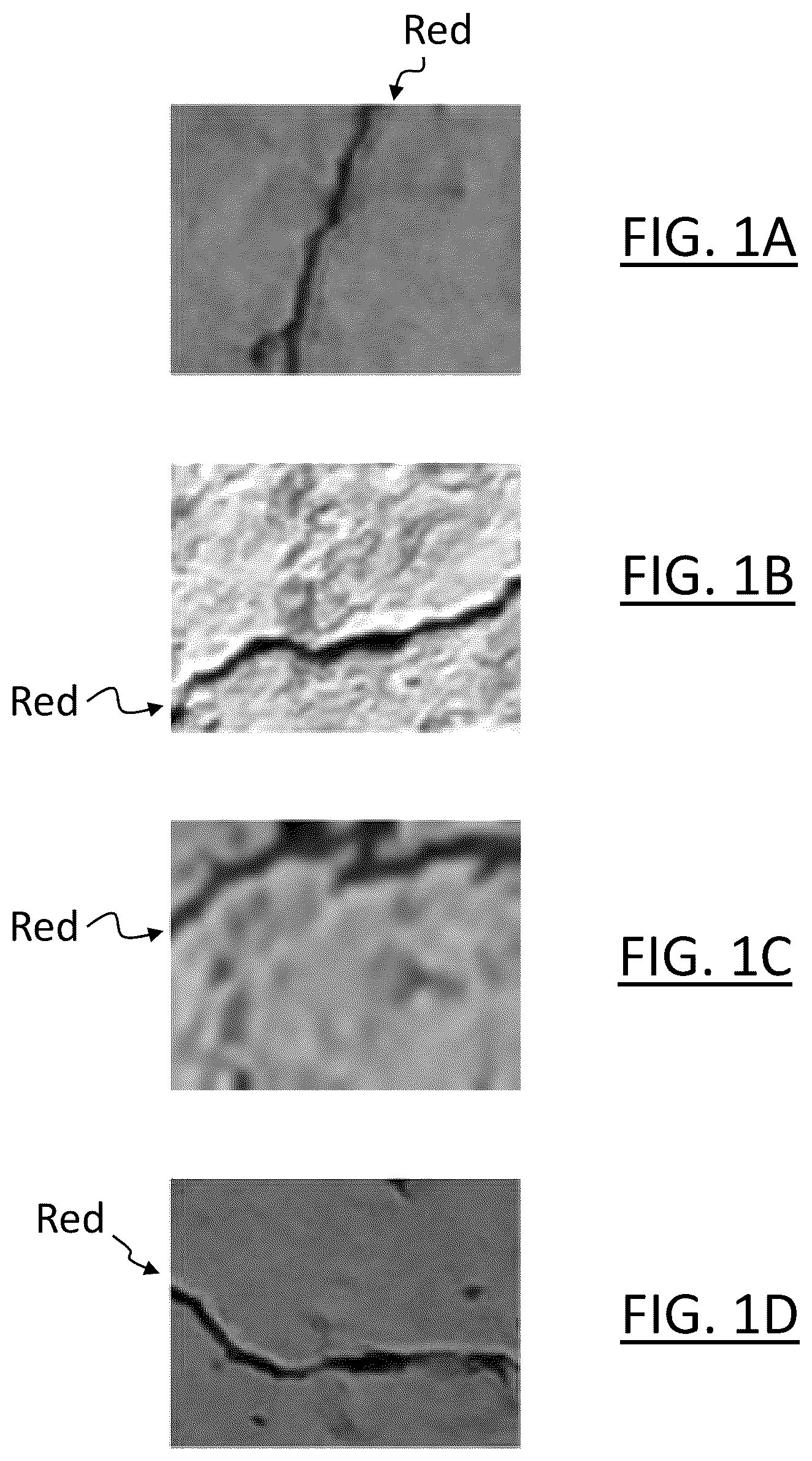 Patent US12315238 Figure 1 – Computer-implemented arrangements for processing image having article of interest