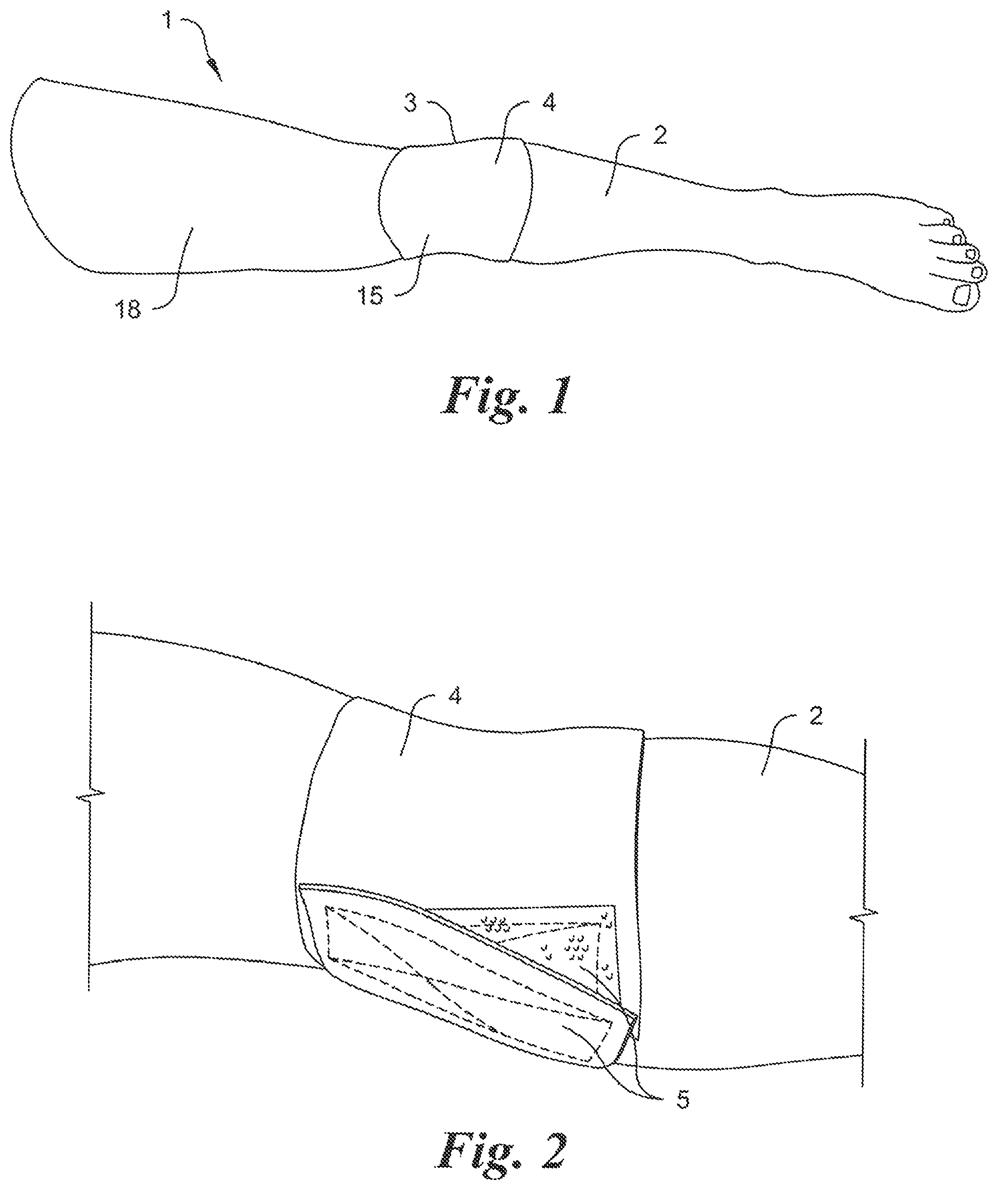 Patent US12315388 Figure 1 – Intraosseous infusion trainer