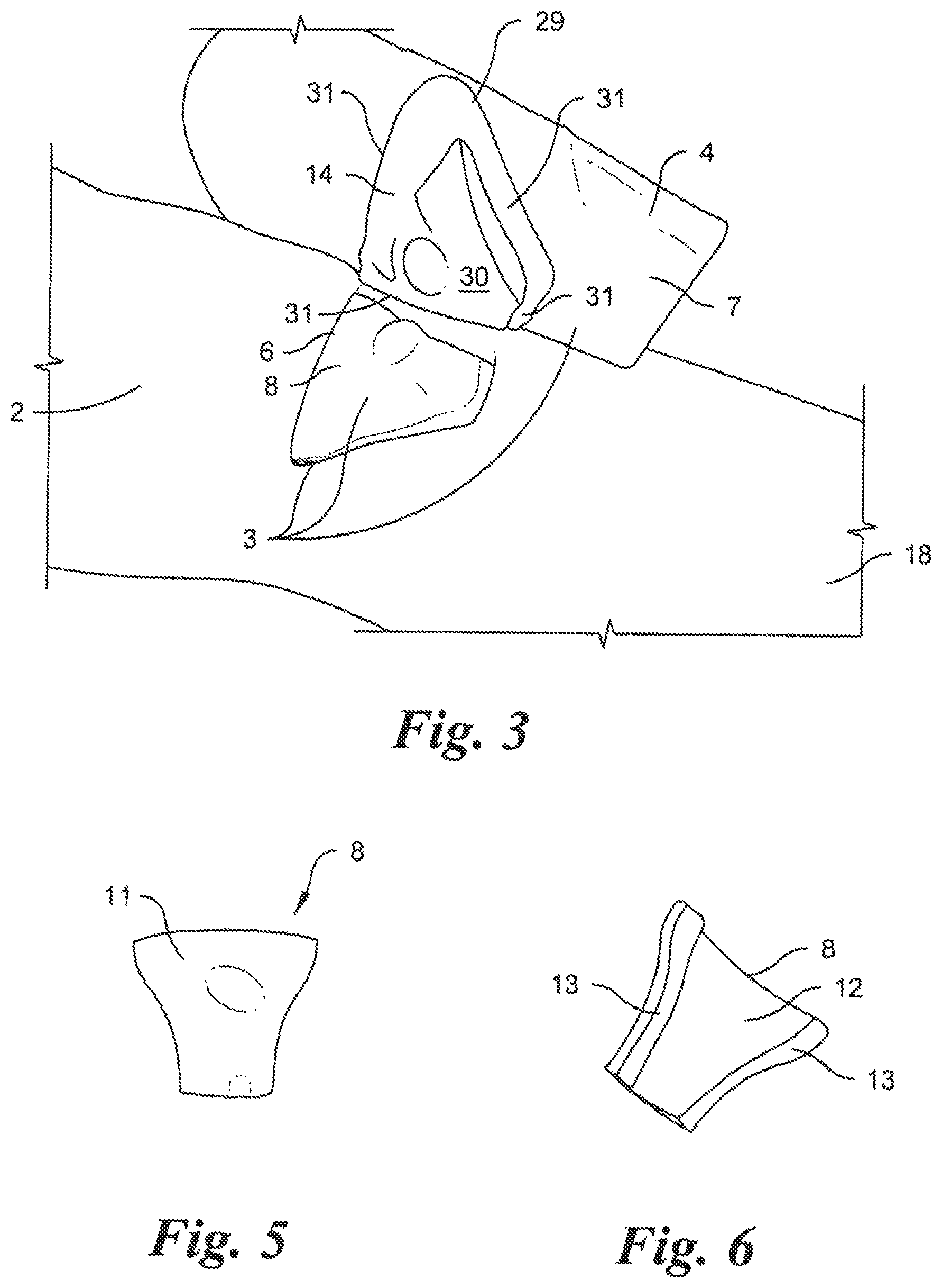 Patent US12315388 Figure 2 – Intraosseous infusion trainer