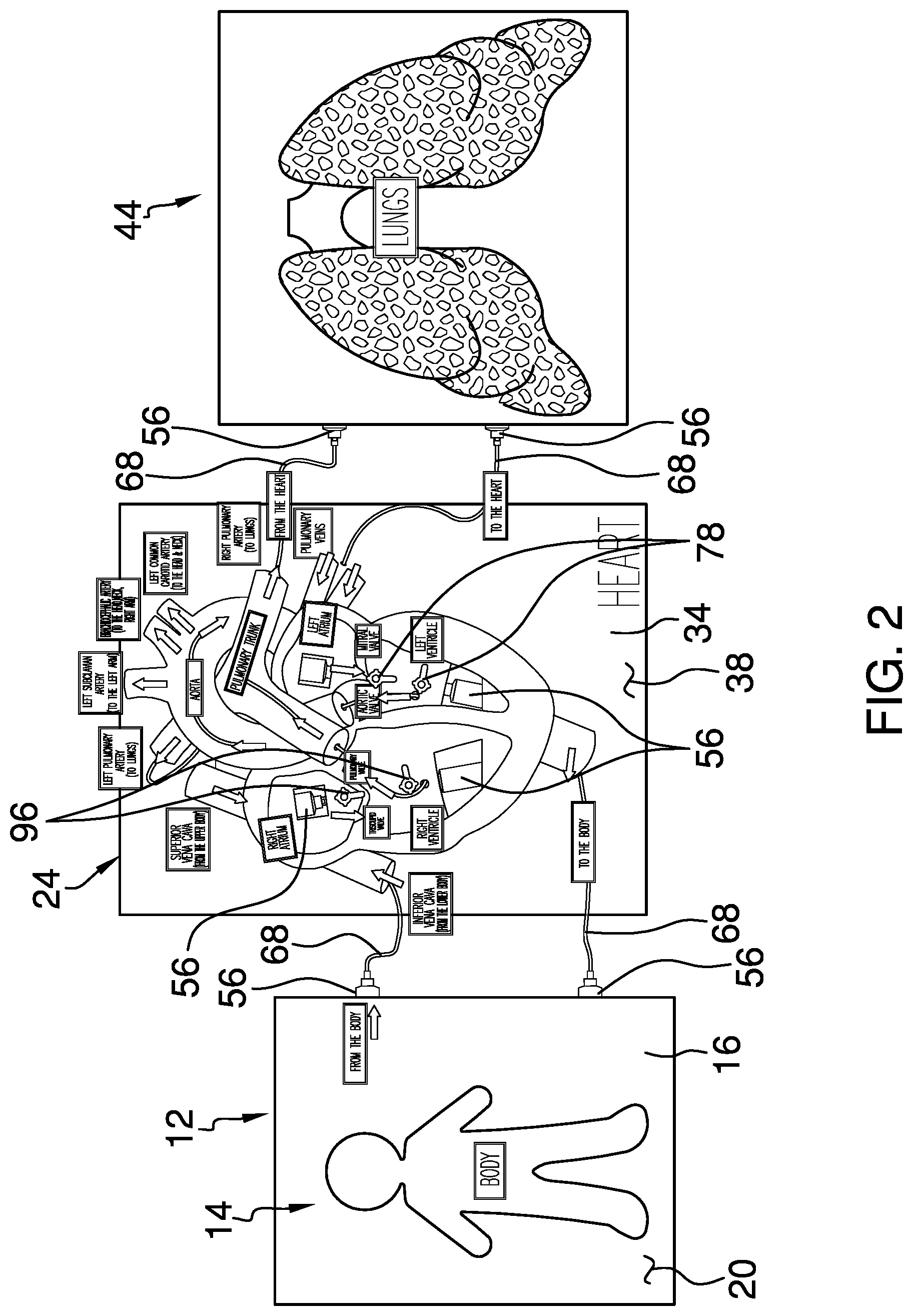 Patent US12315389 Figure 2 – Anatomy education assembly