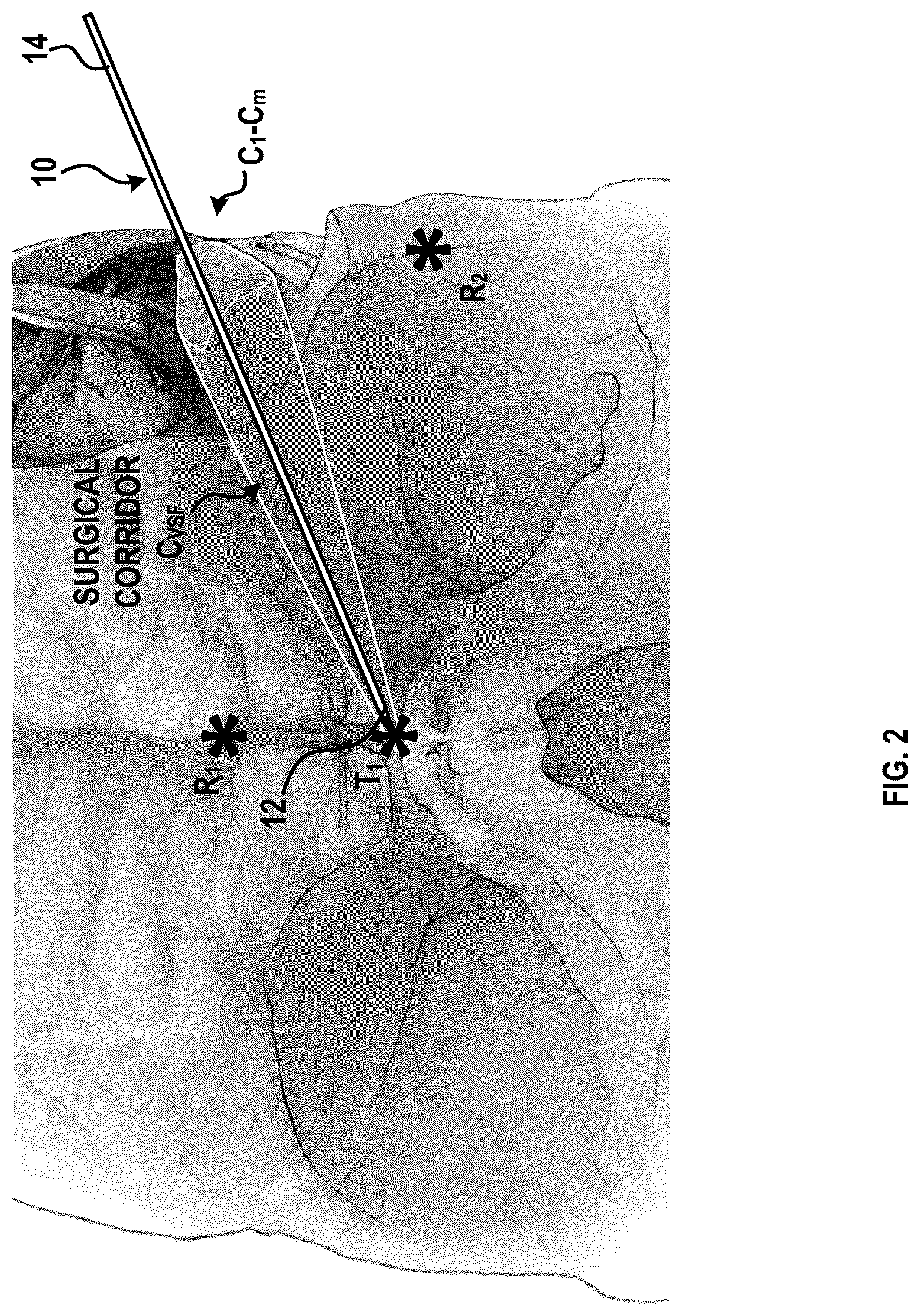 Patent US12315616 Figure 3 – Systems and methods for a spatial quantitative and anatomically accurate surgical corridor modeling platform