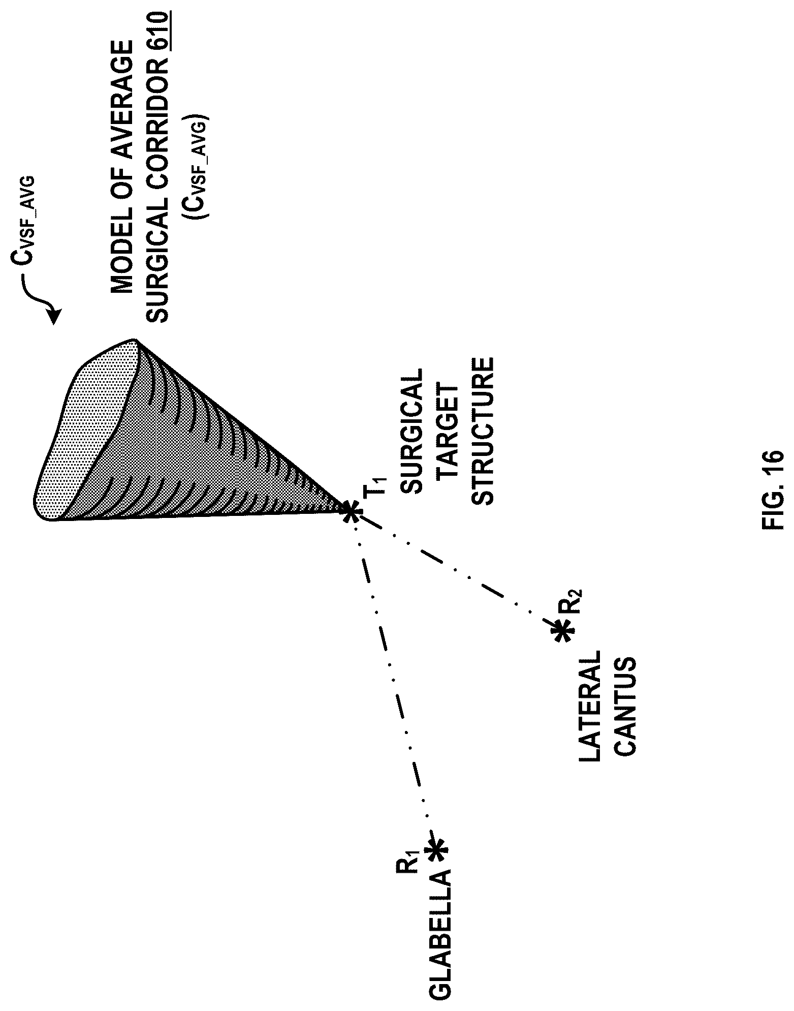 Patent US12315616 Figure 17 – Systems and methods for a spatial quantitative and anatomically accurate surgical corridor modeling platform
