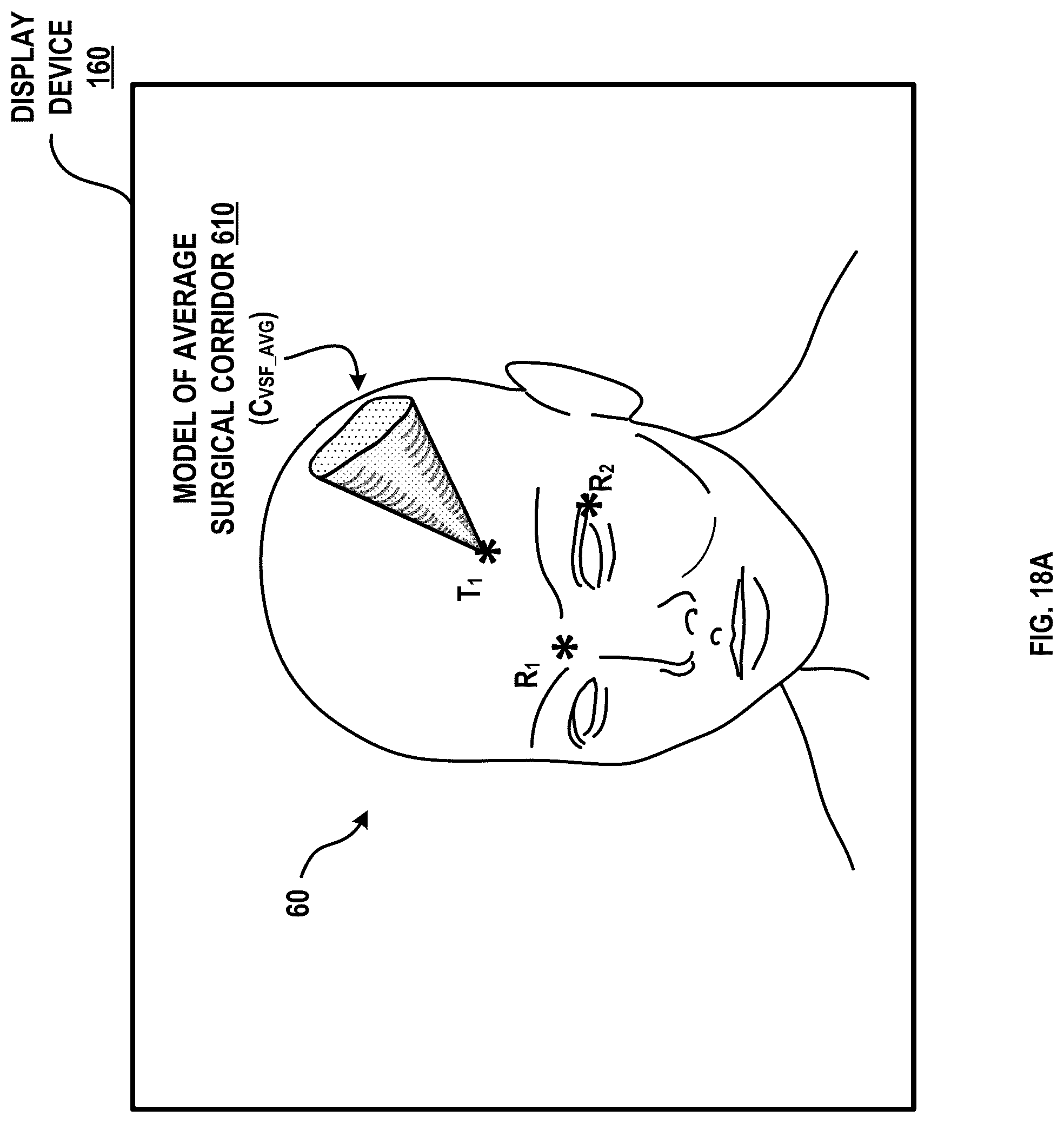 Patent US12315616 Figure 19 – Systems and methods for a spatial quantitative and anatomically accurate surgical corridor modeling platform