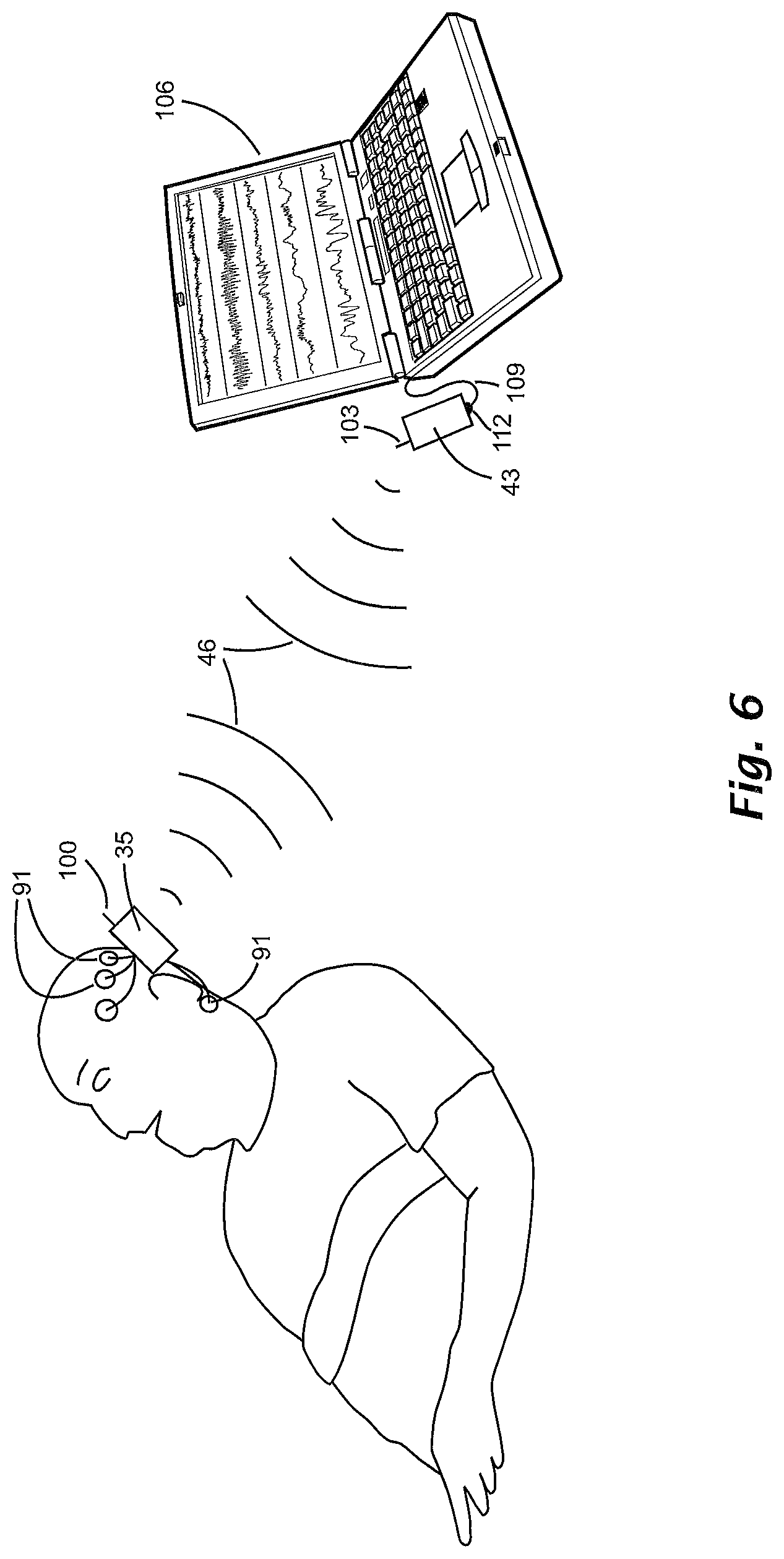 Patent US12315618 Figure 6 – Method and device for sleep analysis