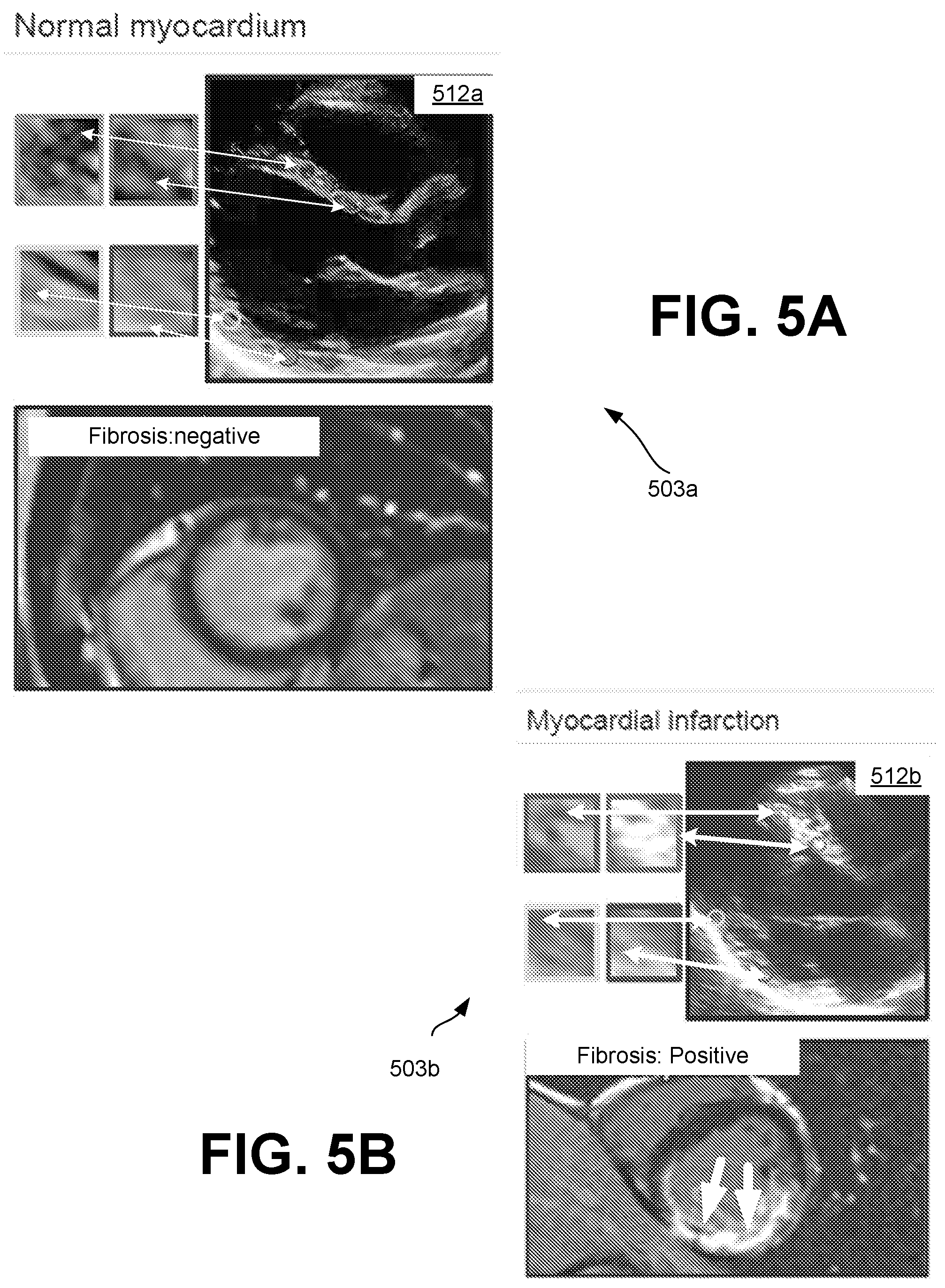 Patent US12315621 Figure 7 – Cardiac ultrasonic fingerprinting: an approach for highthroughput myocardial feature phenotyping