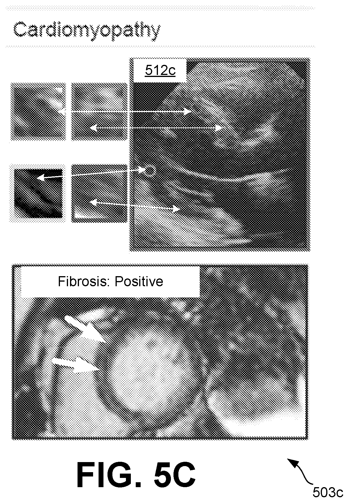 Patent US12315621 Figure 8 – Cardiac ultrasonic fingerprinting: an approach for highthroughput myocardial feature phenotyping