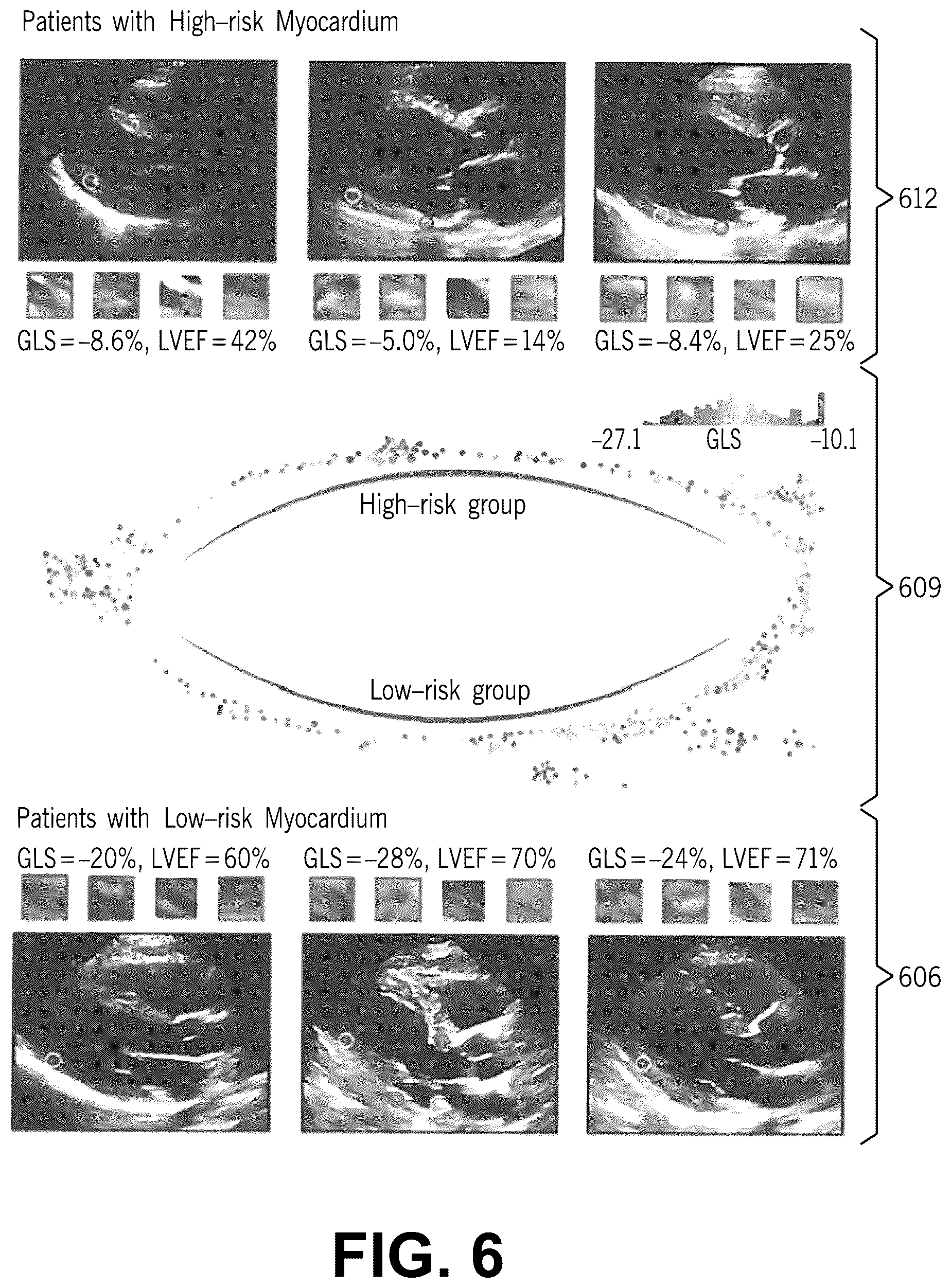 Patent US12315621 Figure 9 – Cardiac ultrasonic fingerprinting: an approach for highthroughput myocardial feature phenotyping