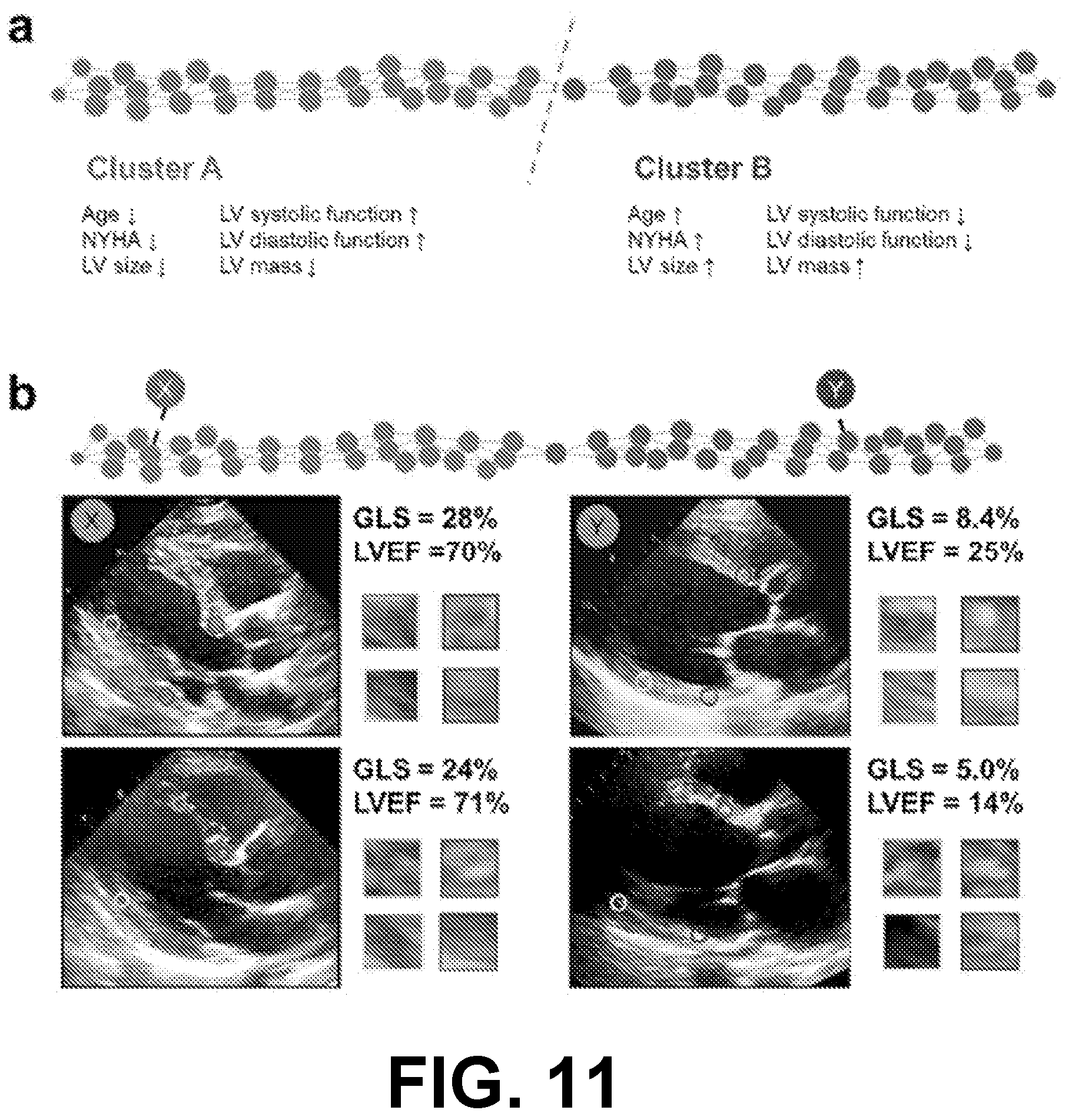 Patent US12315621 Figure 14 – Cardiac ultrasonic fingerprinting: an approach for highthroughput myocardial feature phenotyping