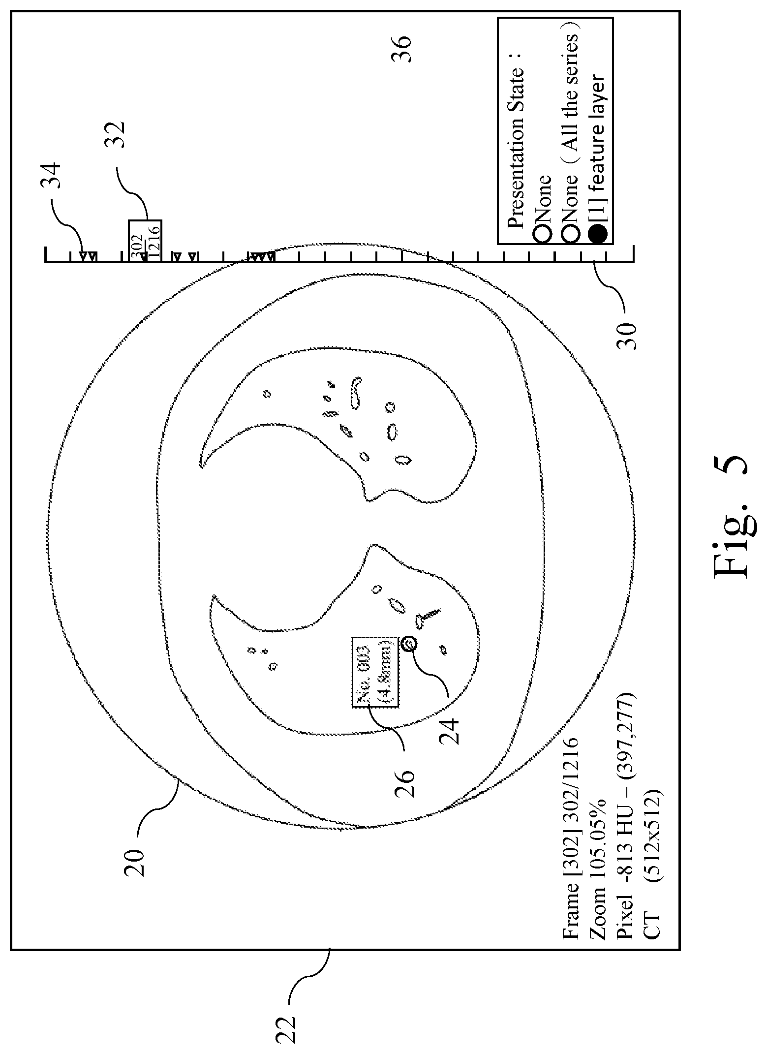 Patent US12315622 Figure 5 – Medical image paging display system