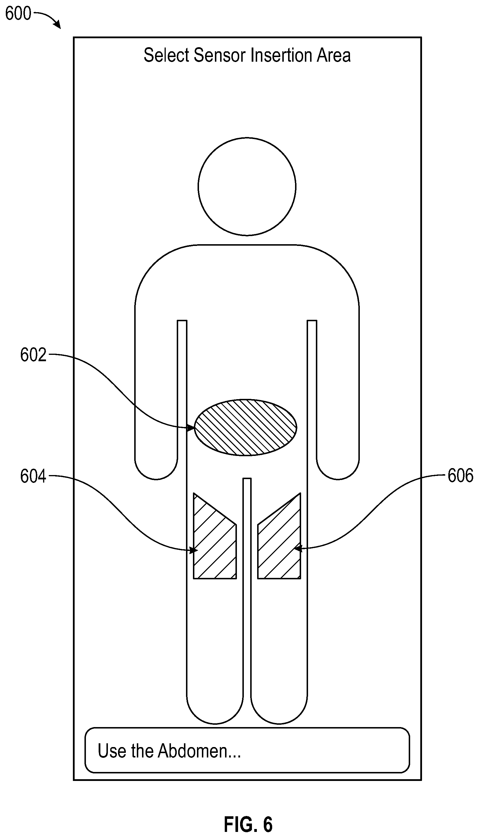 Patent US12315631 Figure 6 – Medical device site monitoring methods and related devices and systems