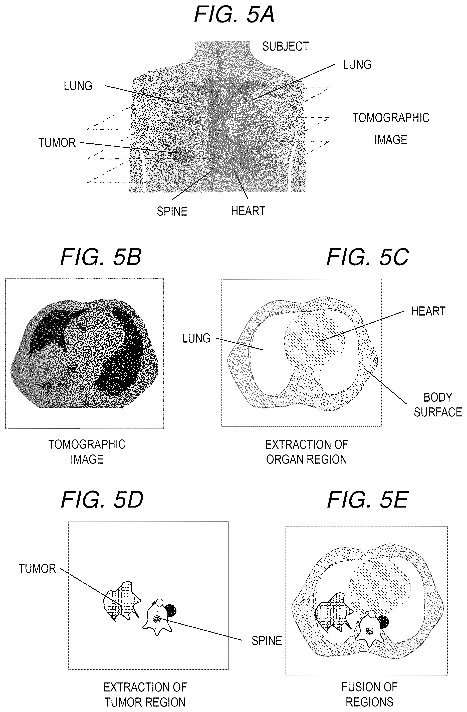 Patent US12315633 Figure 5 – Medical image processing apparatus and medical image processing method