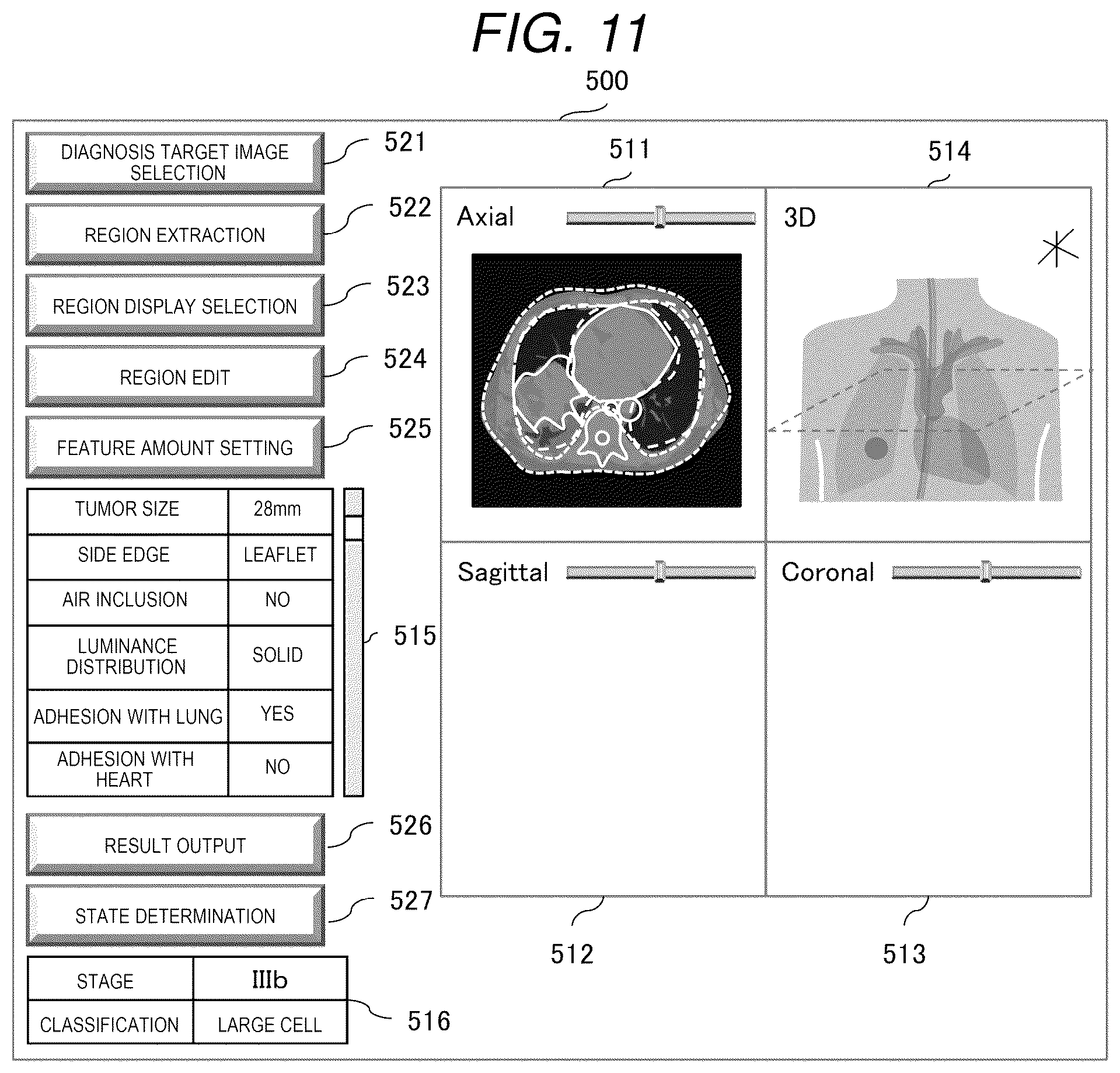 Patent US12315633 Figure 11 – Medical image processing apparatus and medical image processing method