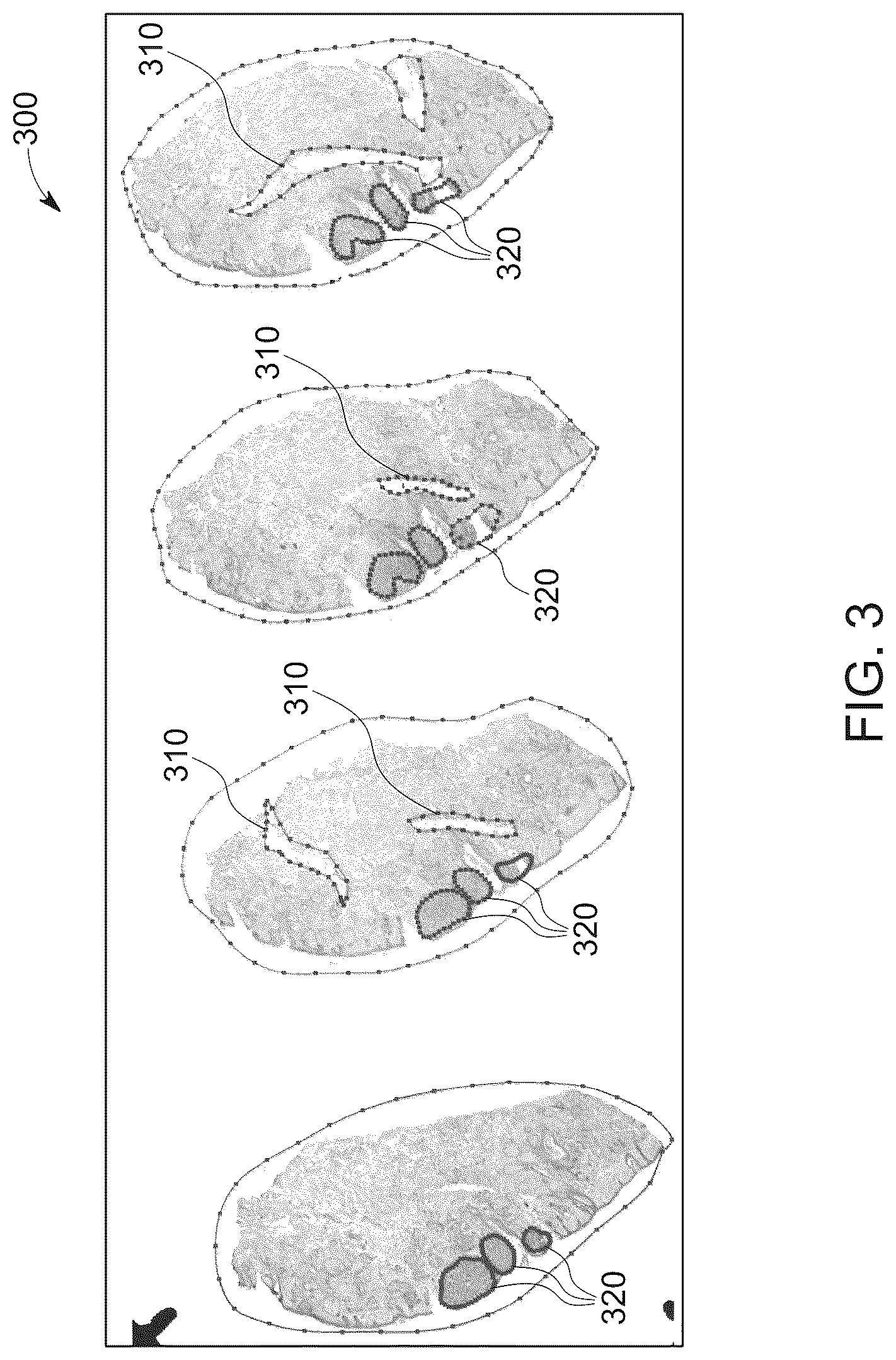 Patent US12315636 Figure 4 – System and method for automation of surgical pathology processes using artificial intelligence