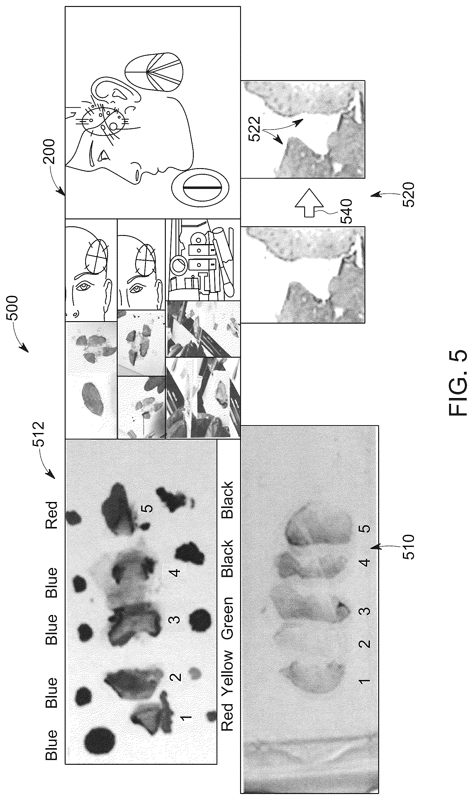Patent US12315636 Figure 6 – System and method for automation of surgical pathology processes using artificial intelligence