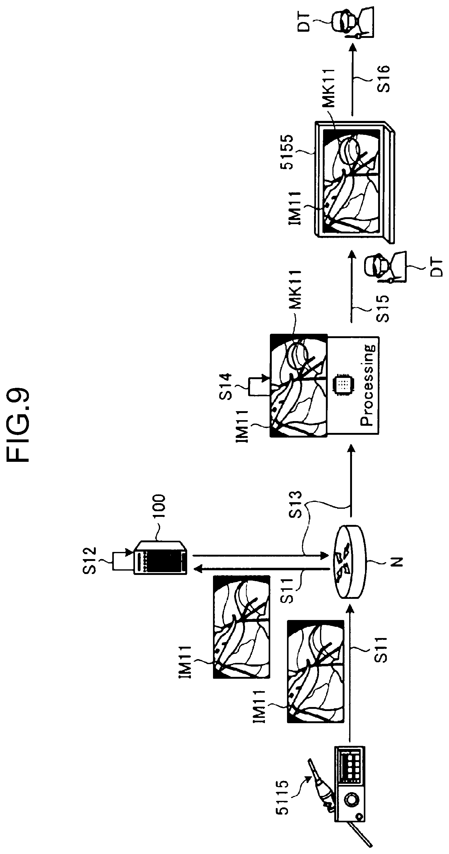 Patent US12315638 Figure 7 – Surgery support system, surgery support method, information processing apparatus, and information processing program
