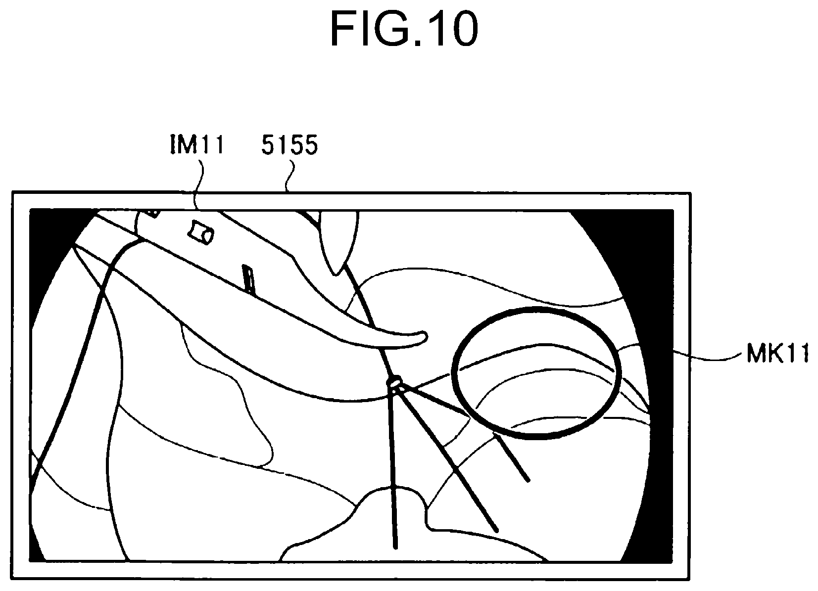 Patent US12315638 Figure 8 – Surgery support system, surgery support method, information processing apparatus, and information processing program