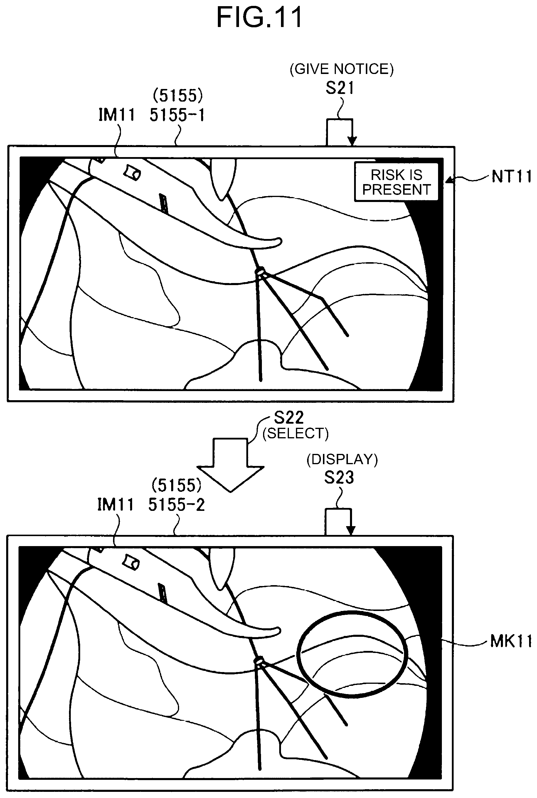 Patent US12315638 Figure 9 – Surgery support system, surgery support method, information processing apparatus, and information processing program