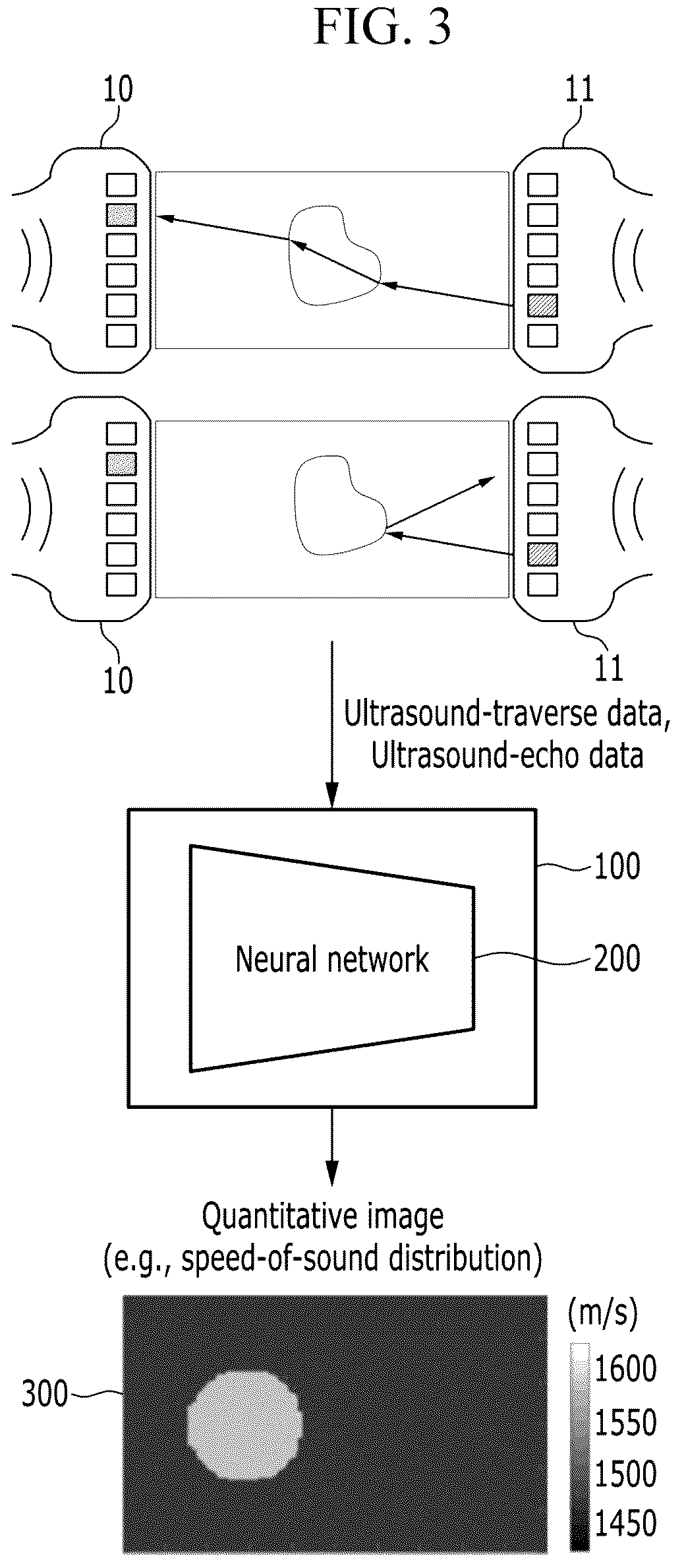 Patent US12315641 Figure 3 – Method and apparatus for quantitative imaging using ultrasound data