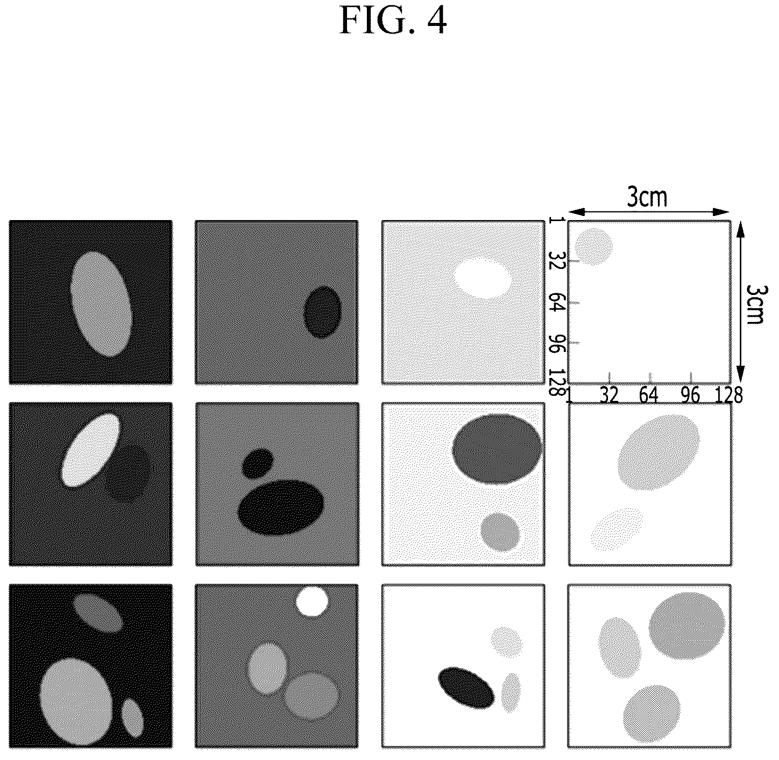 Patent US12315641 Figure 4 – Method and apparatus for quantitative imaging using ultrasound data