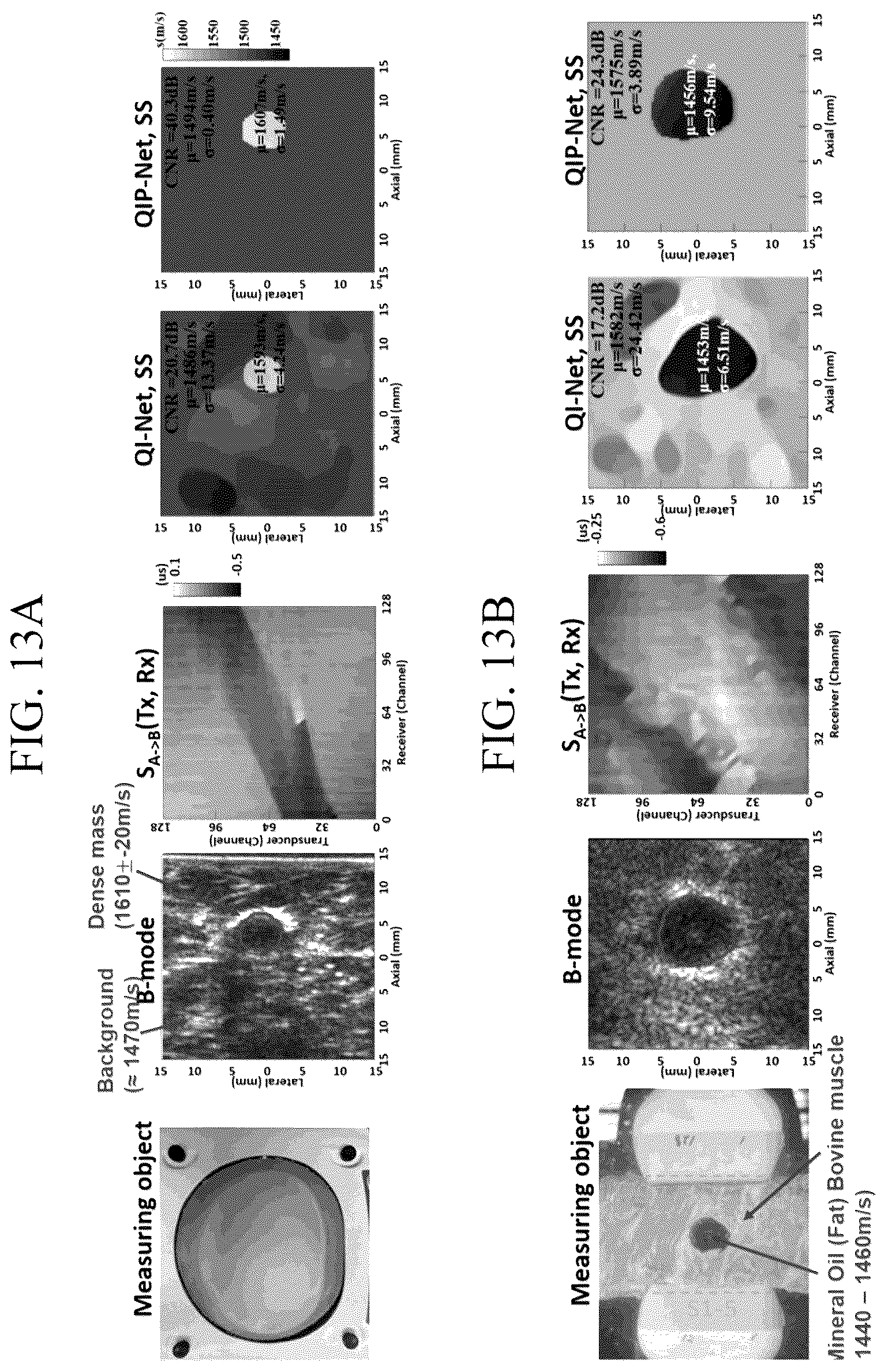 Patent US12315641 Figure 13 – Method and apparatus for quantitative imaging using ultrasound data