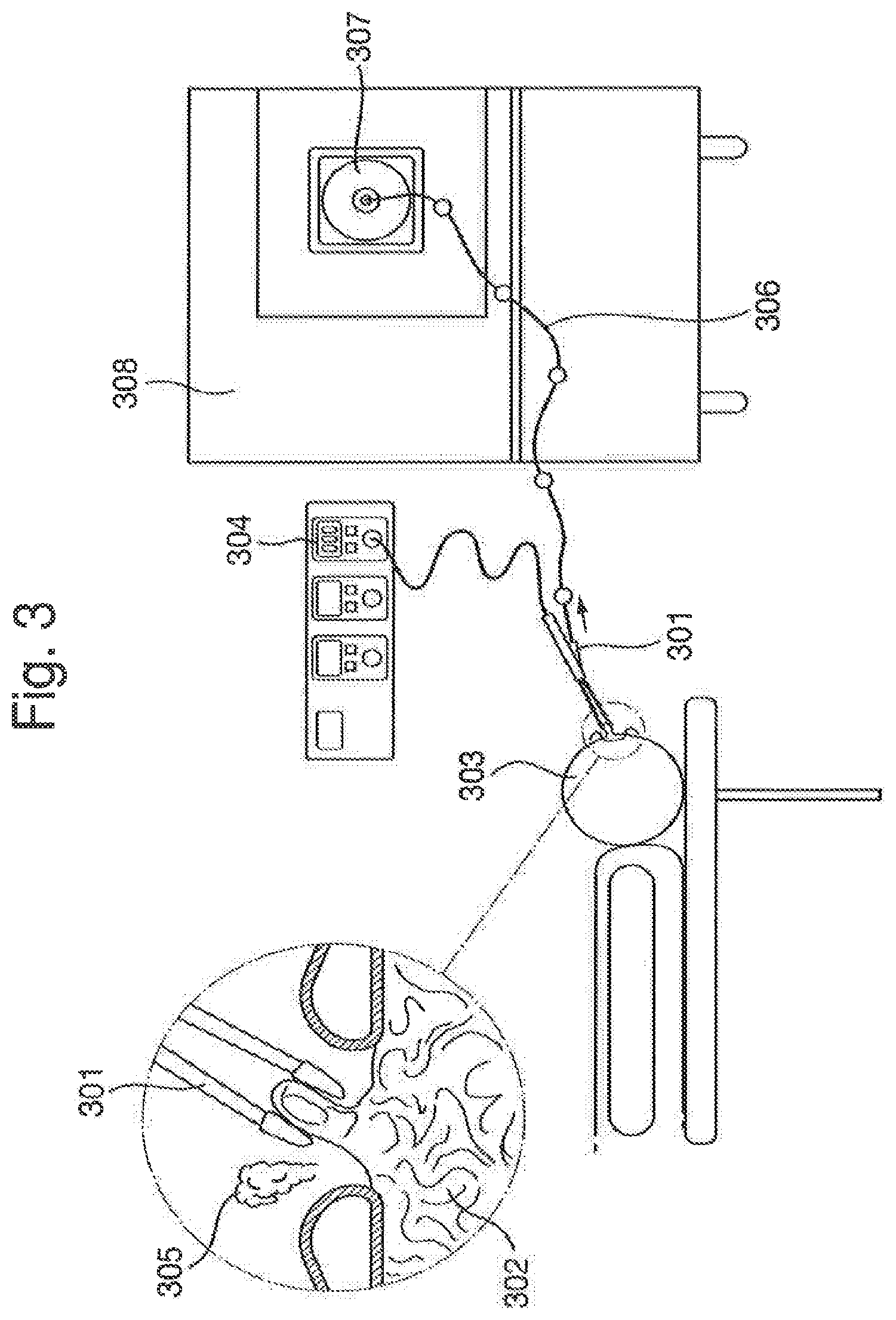Patent US12315714 Figure 3 – Tissue analysis by mass spectrometry or ion mobility spectrometry