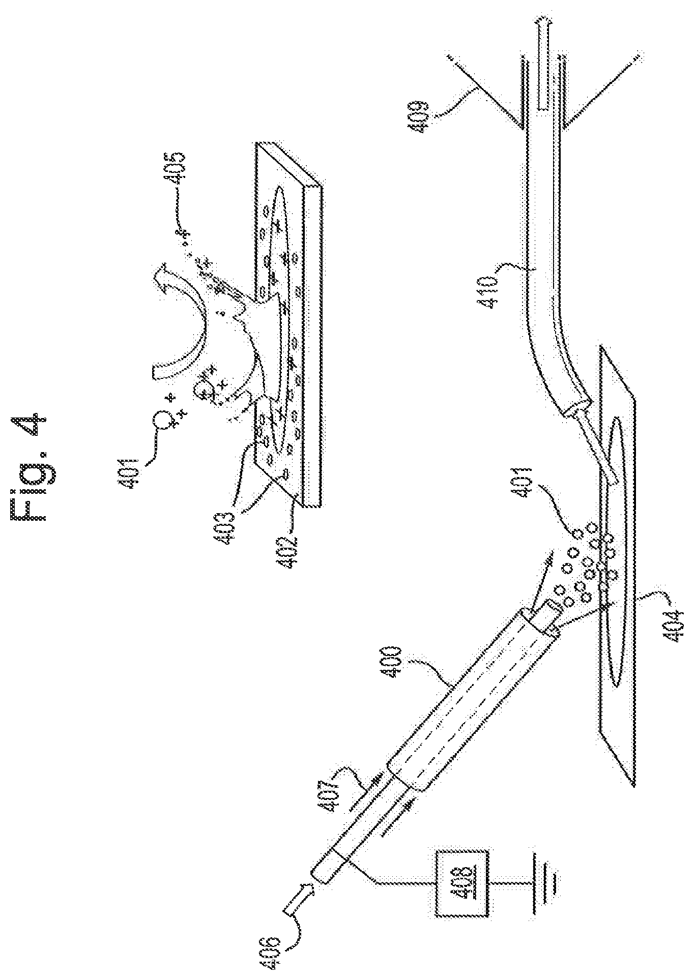 Patent US12315714 Figure 4 – Tissue analysis by mass spectrometry or ion mobility spectrometry