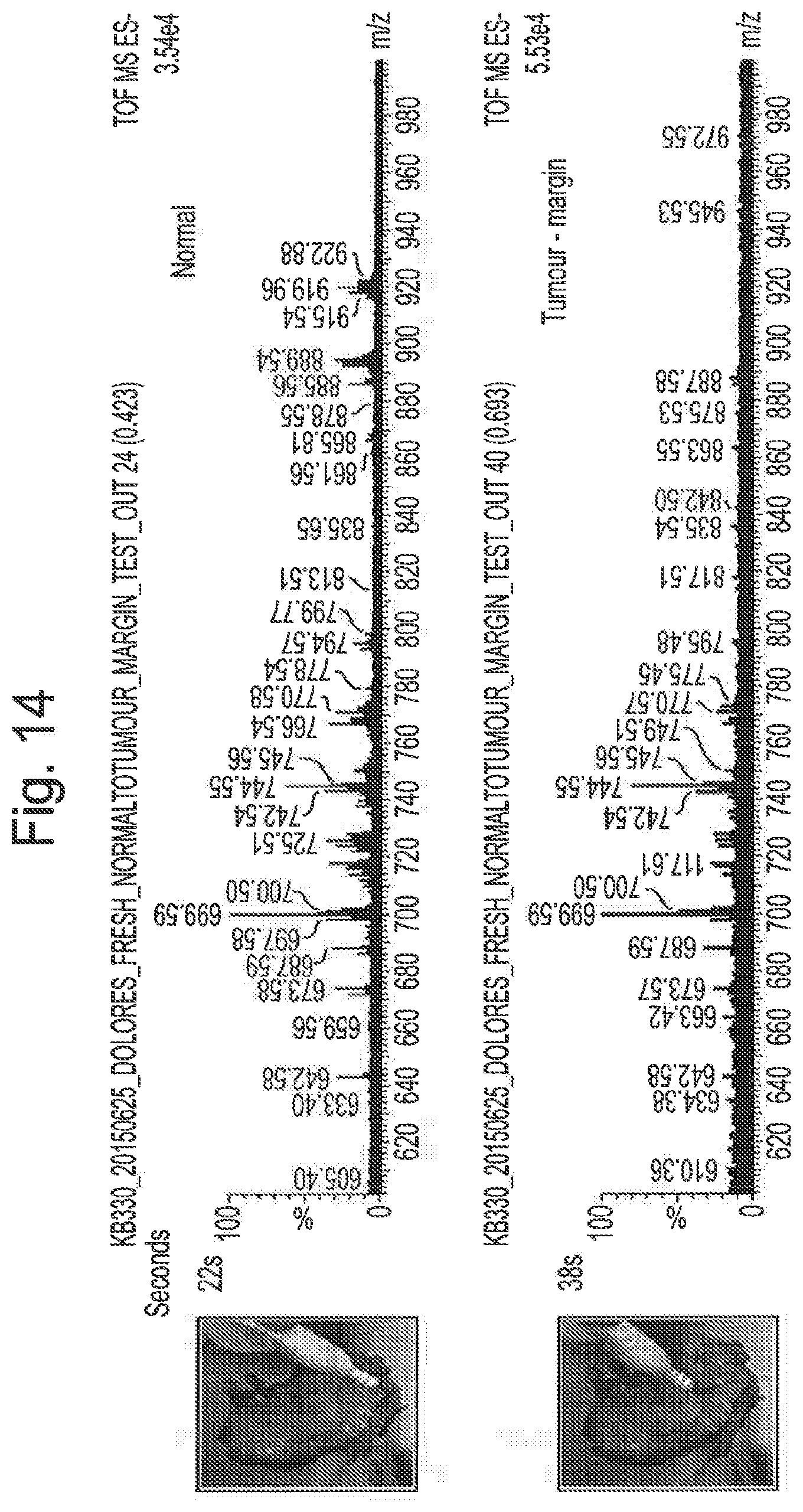 Patent US12315714 Figure 15 – Tissue analysis by mass spectrometry or ion mobility spectrometry