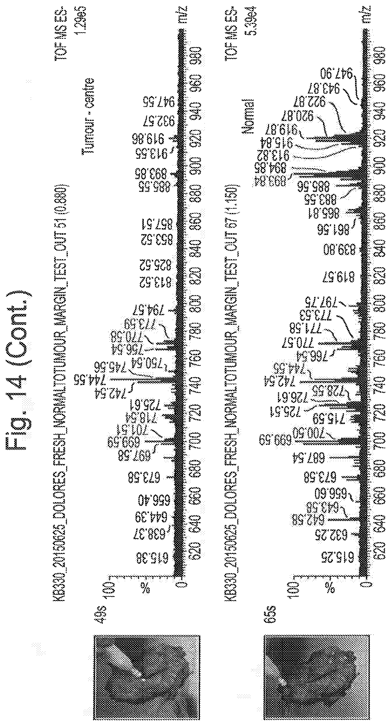 Patent US12315714 Figure 16 – Tissue analysis by mass spectrometry or ion mobility spectrometry