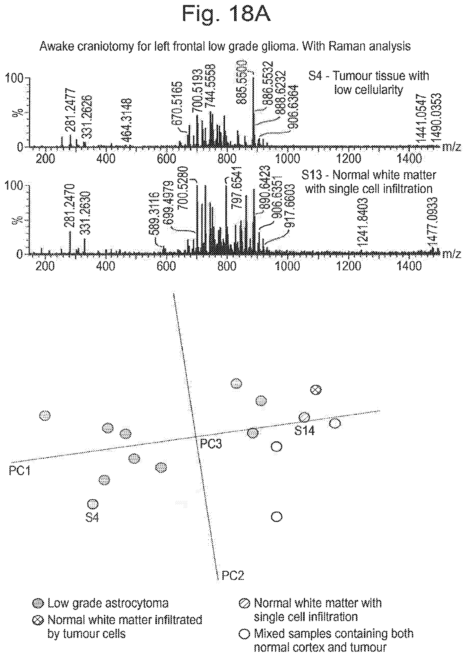 Patent US12315714 Figure 20 – Tissue analysis by mass spectrometry or ion mobility spectrometry