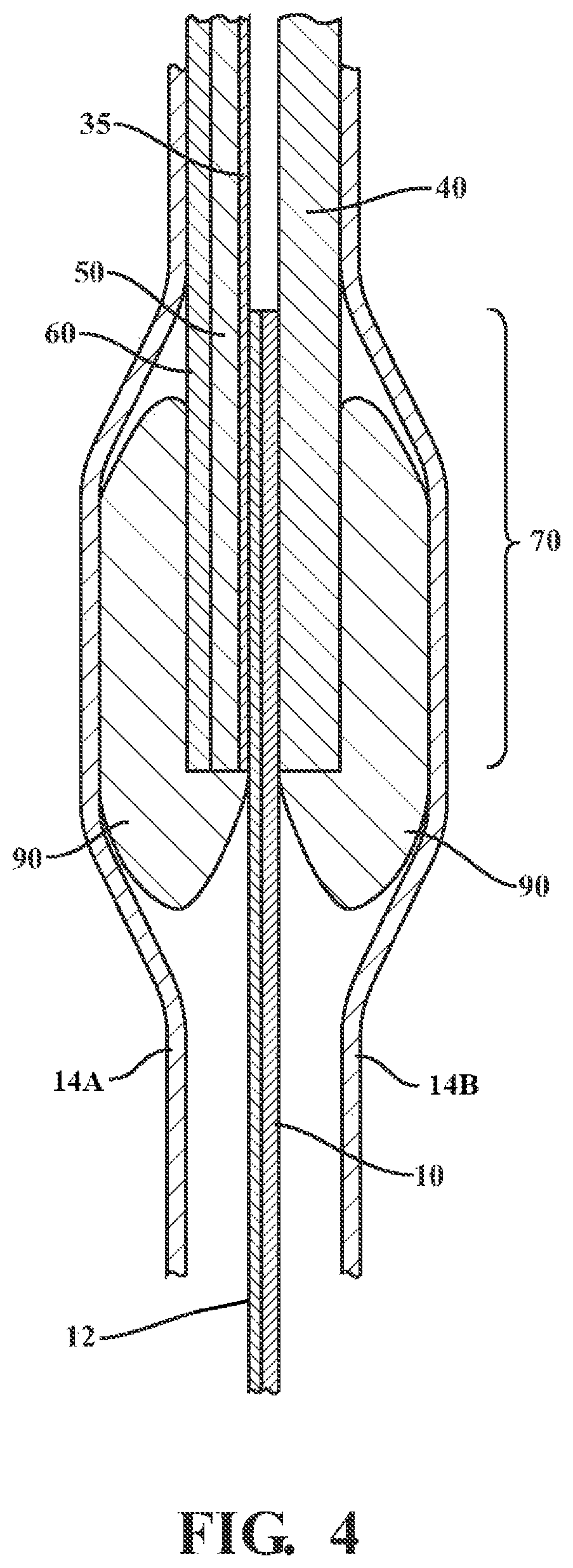 Patent US12315973 Figure 4 – System for fuel cell membrane edge protection via a gas diffusion layer including patterned wettability
