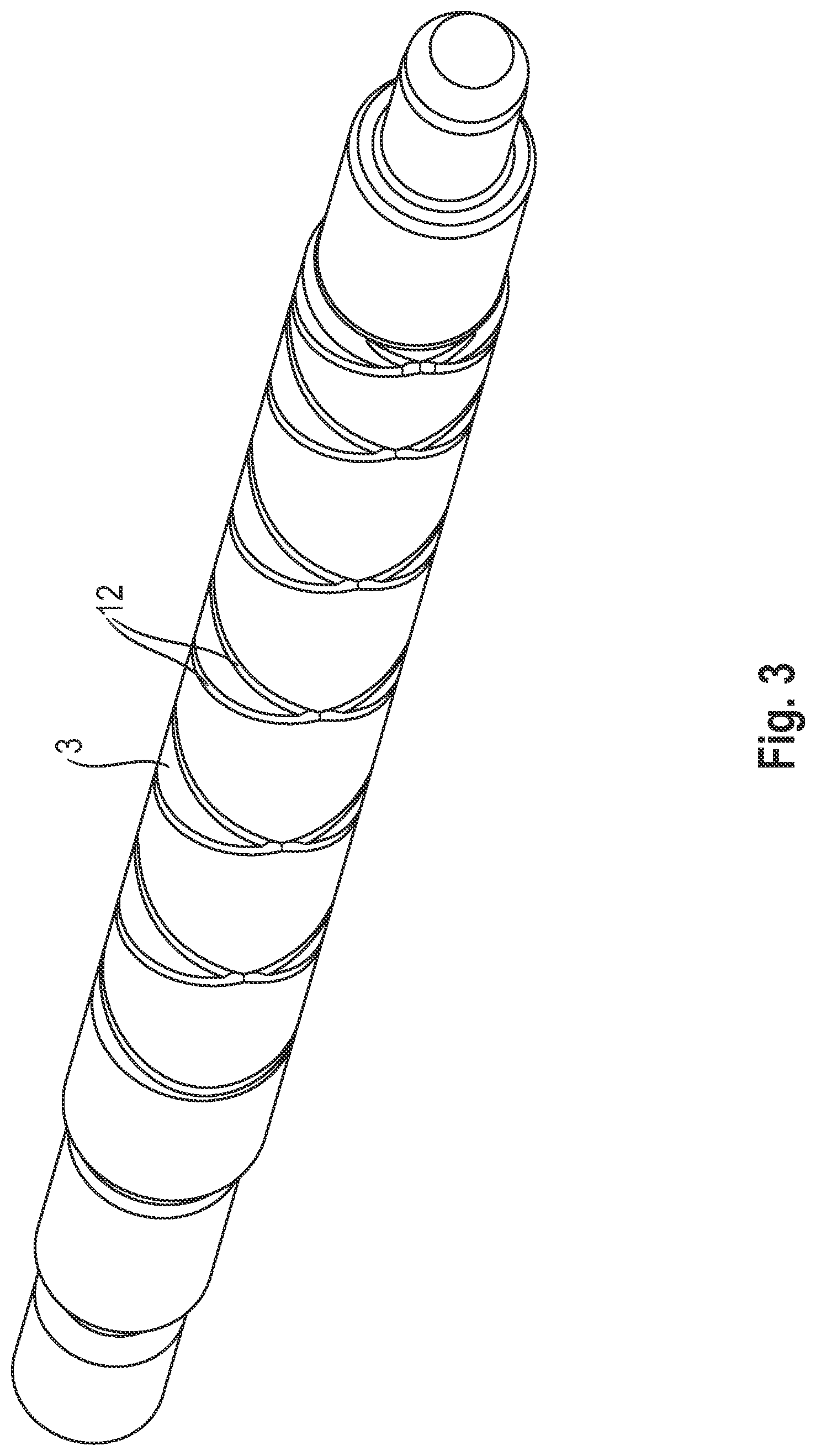 Patent US12316162 Figure 4 – Connection of a rotor shaft to a laminated core