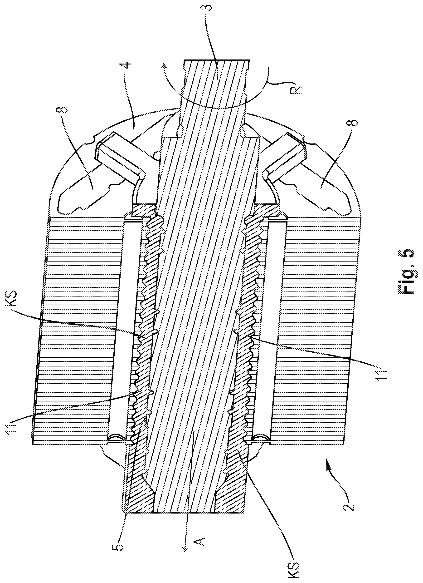 Patent US12316162 Figure 6 – Connection of a rotor shaft to a laminated core