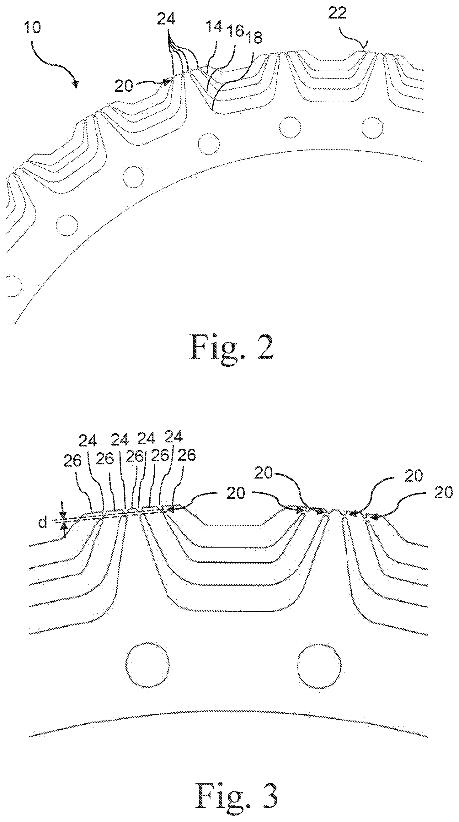 Patent US12316172 Figure 2 – Rotor for an electric ring machine, corresponding ring machine and method for producing a rotor