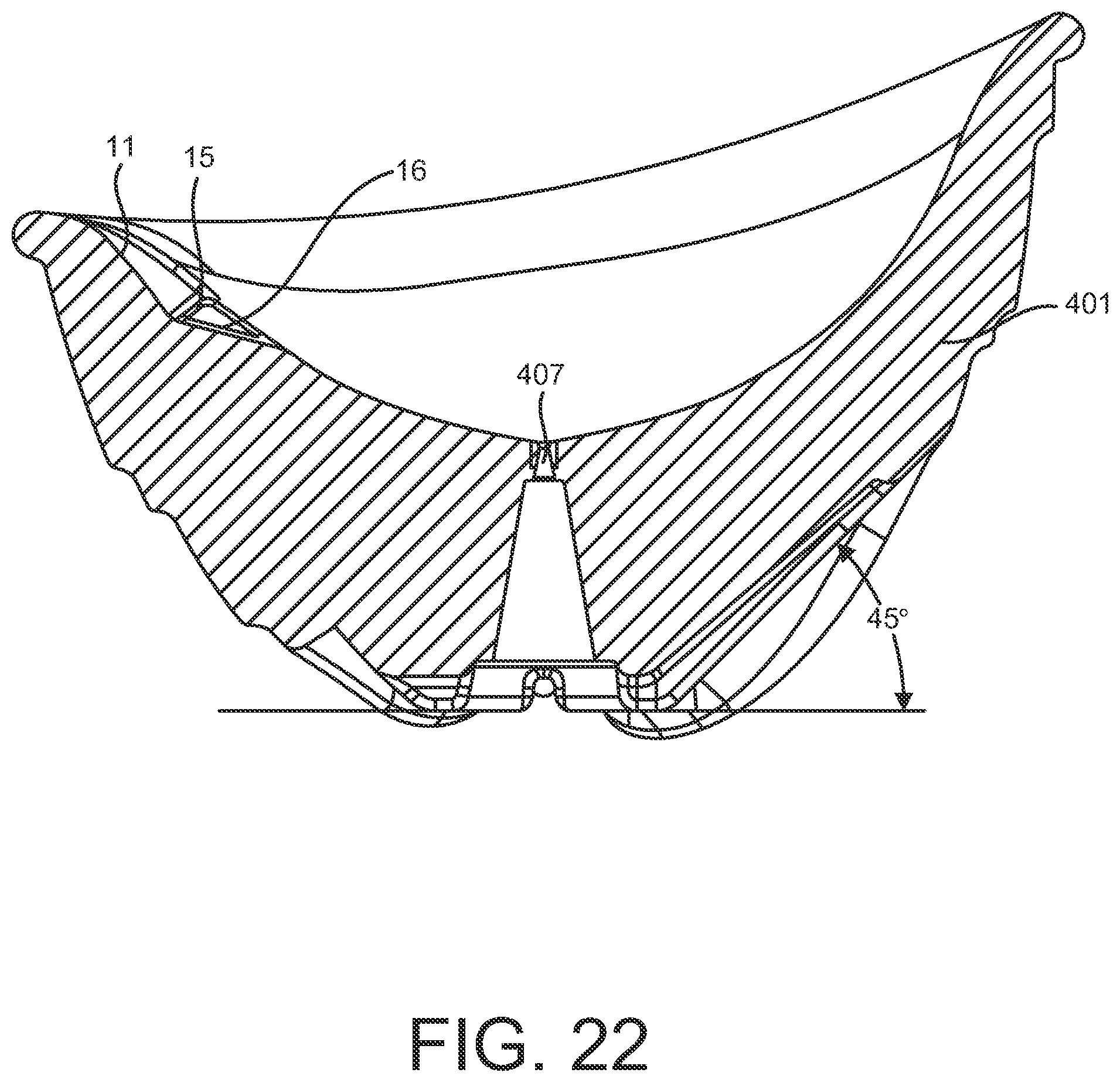 Patent US12316938 Figure 18 – Playground apparatus comprising a camera support