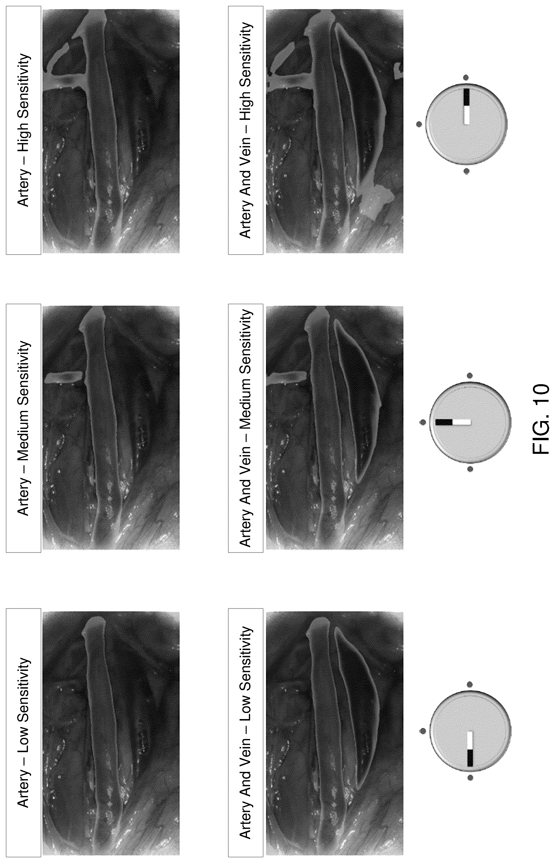 Patent US12316965 Figure 16 – Adaptive overlay stabilization of false color overlay heatmaps