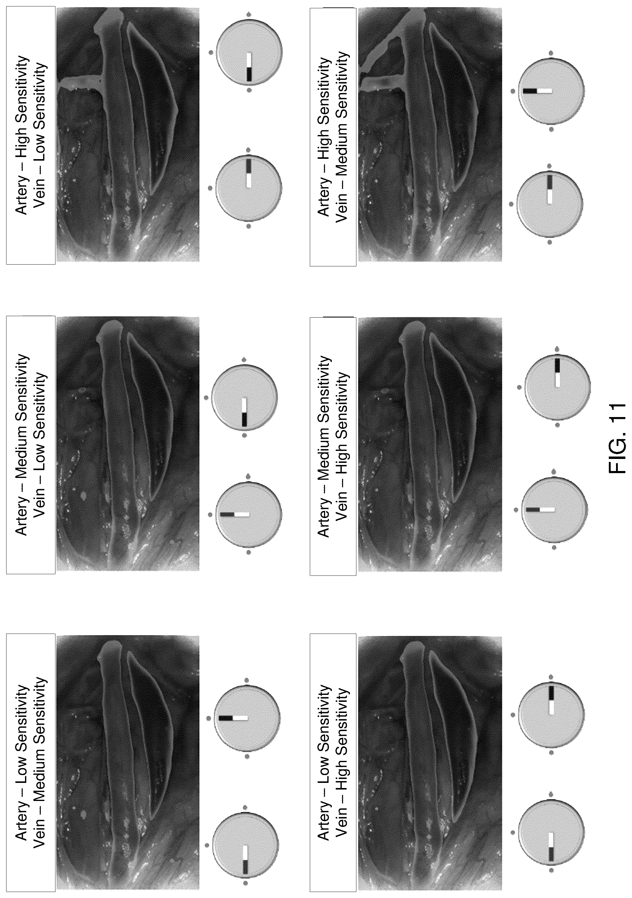 Patent US12316965 Figure 17 – Adaptive overlay stabilization of false color overlay heatmaps