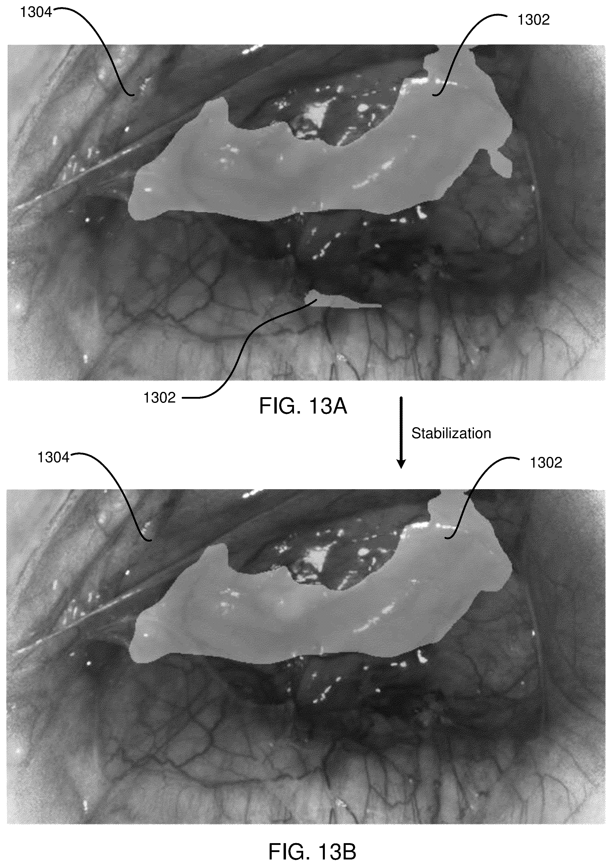 Patent US12316965 Figure 19 – Adaptive overlay stabilization of false color overlay heatmaps