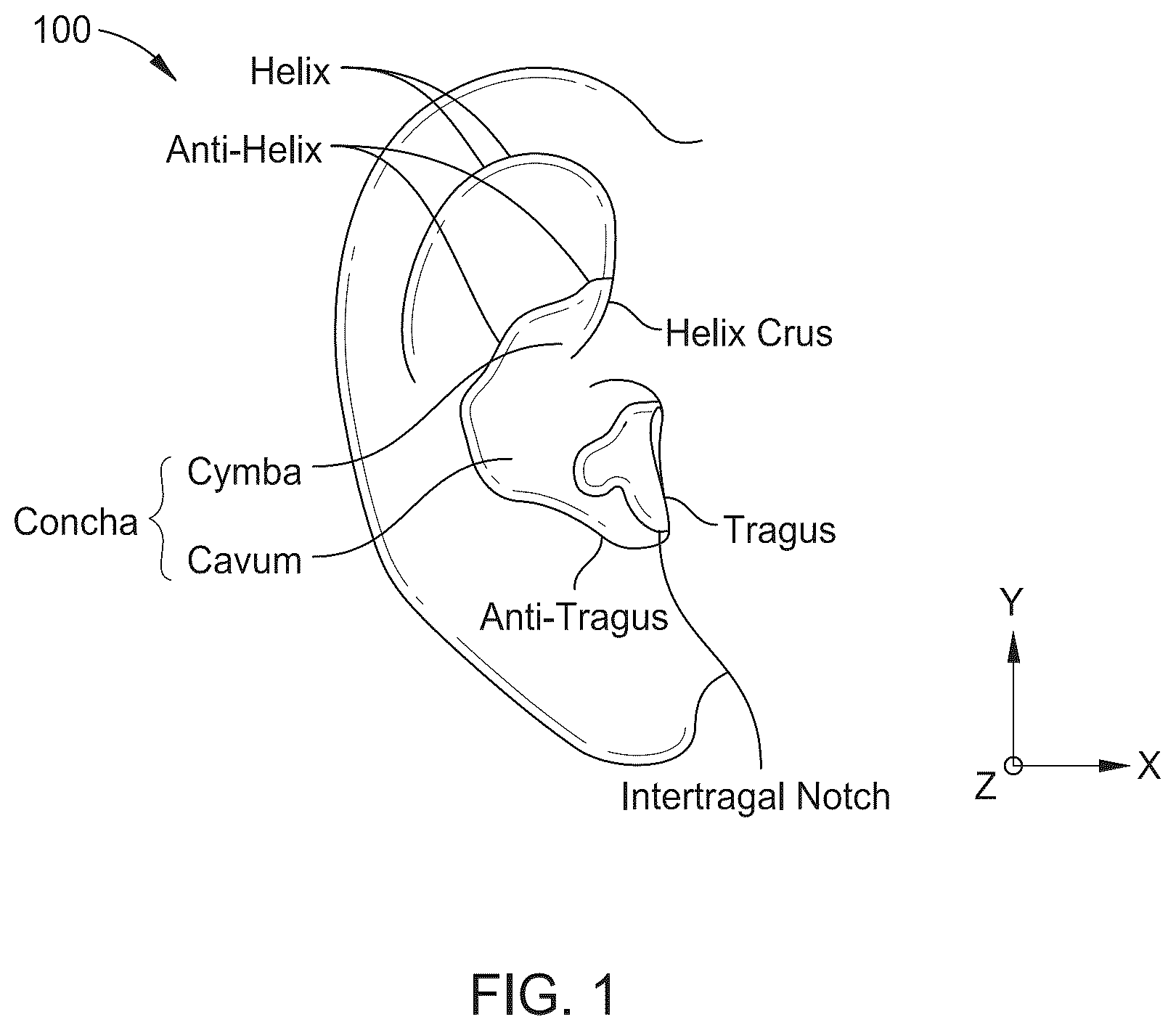 Patent US12317022 — Raised feature on earbud body — Figure 1