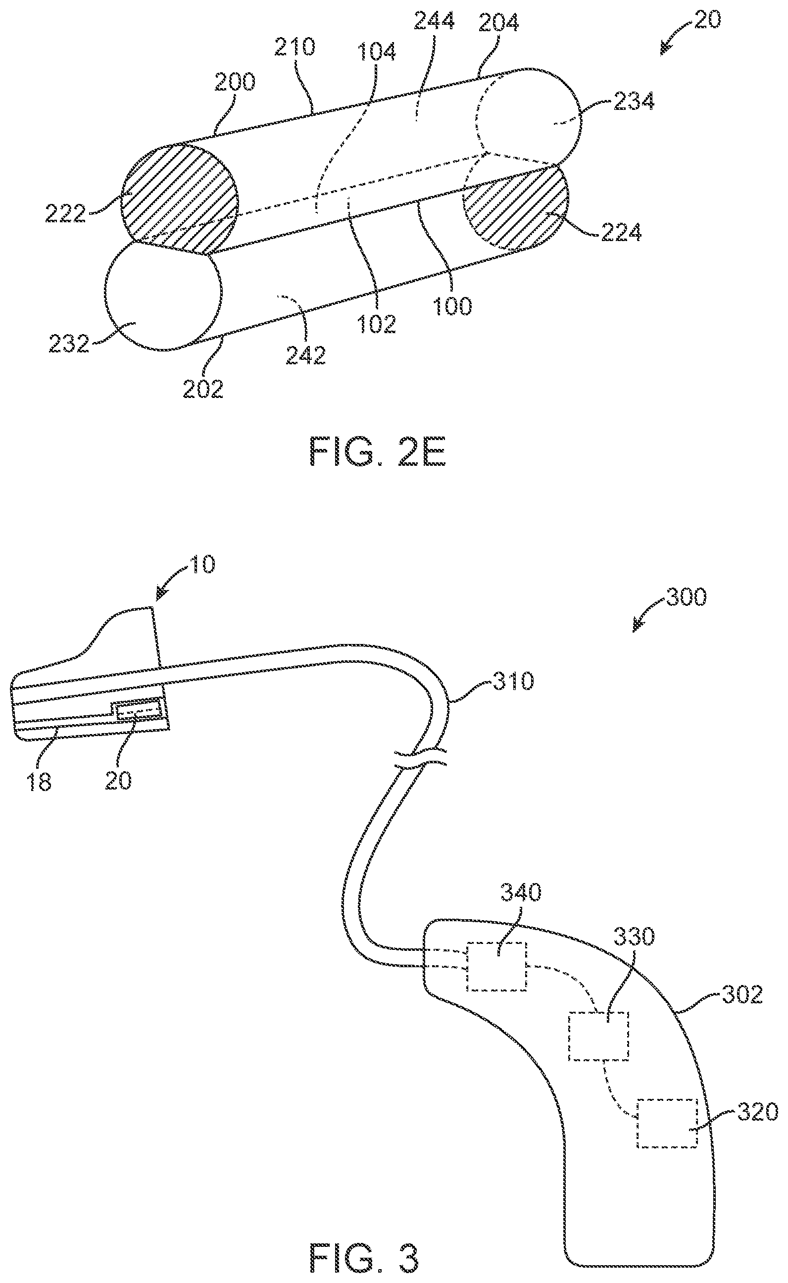 Patent US12317035 Figure 3 – Hearing device for occlusion reduction and components thereof