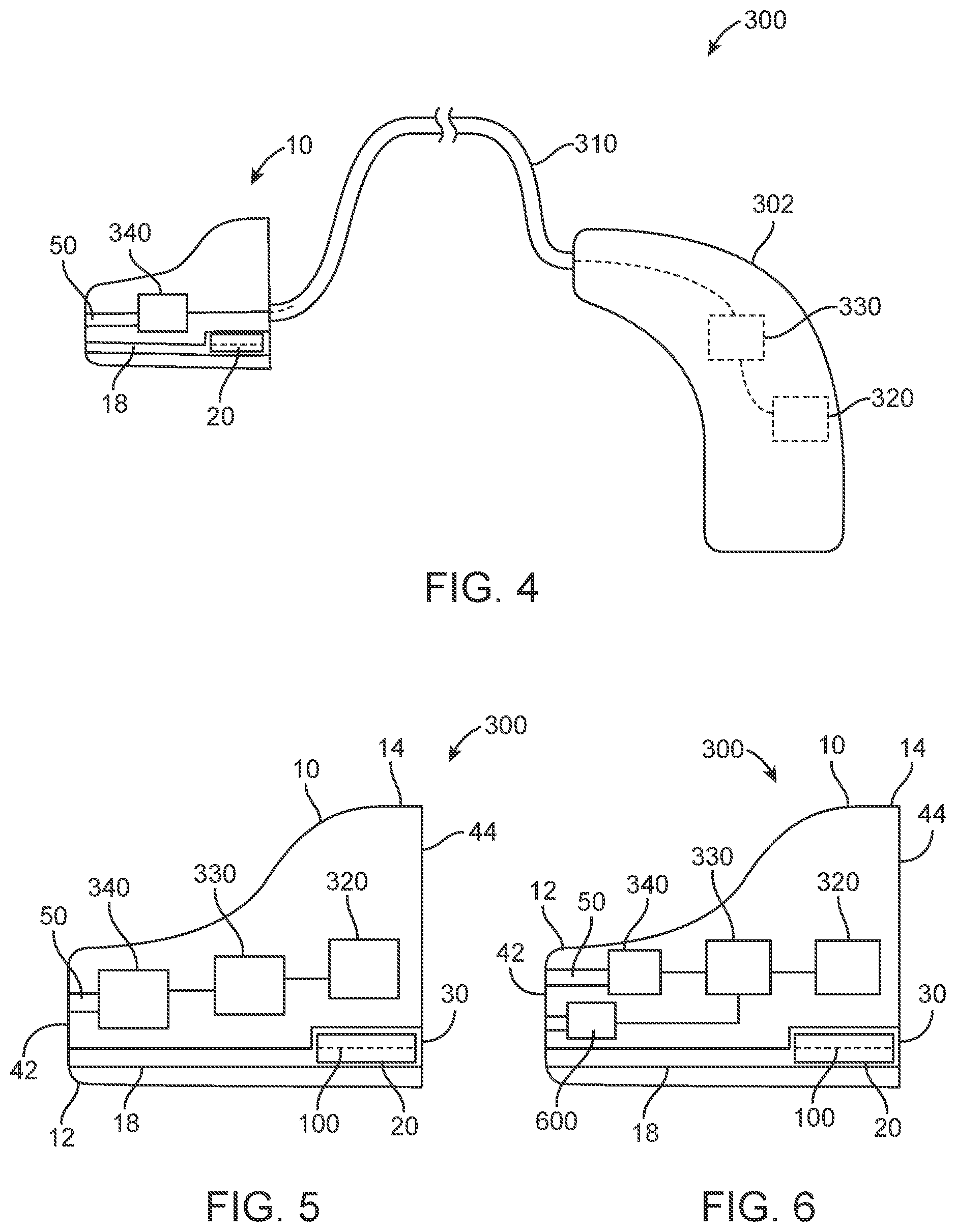 Patent US12317035 Figure 4 – Hearing device for occlusion reduction and components thereof