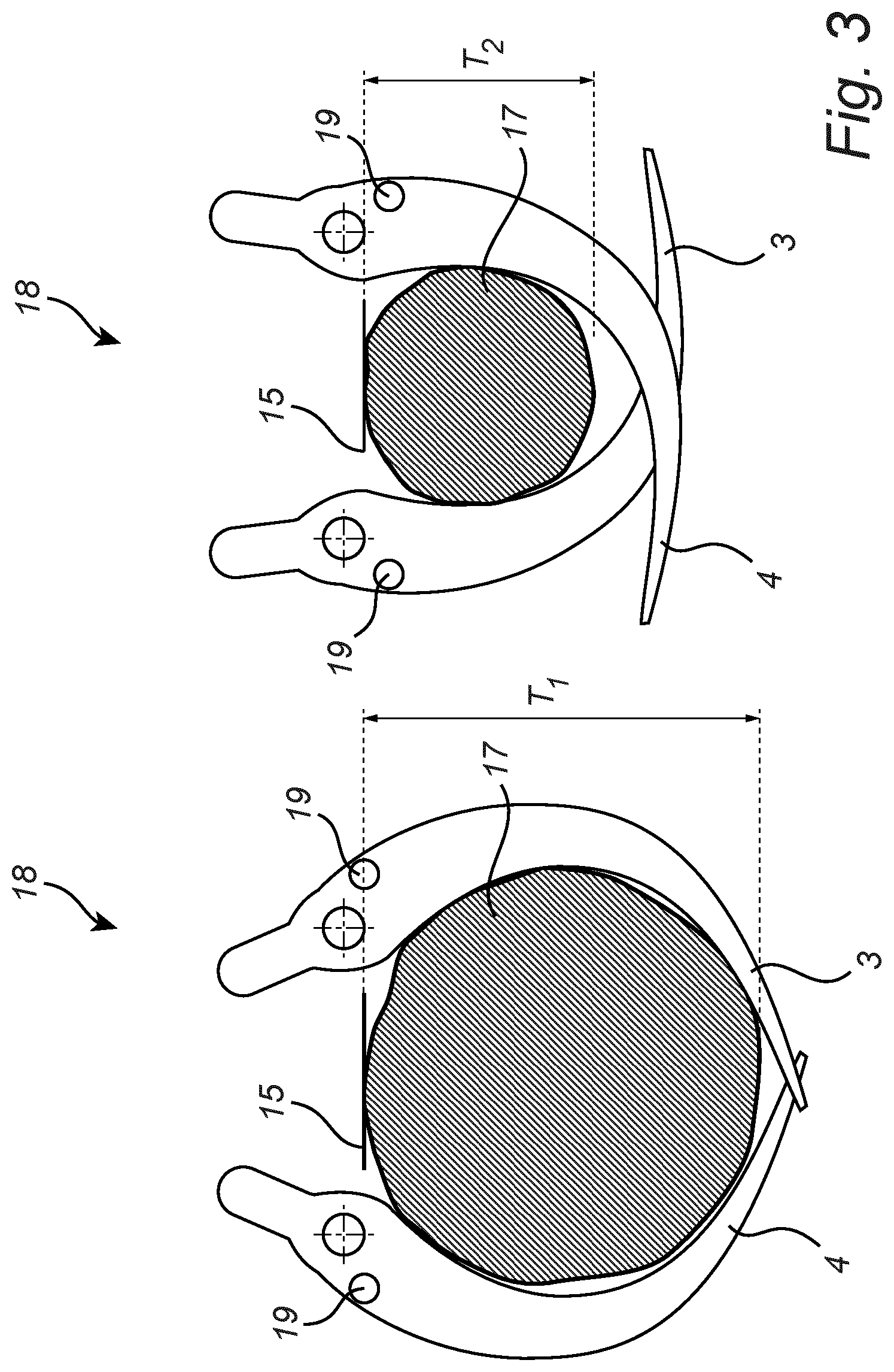 Patent US12317787 Figure 3 – Harvesting head for forestry and a method for determining a thickness of a tree trunk in a harvesting head for forestry